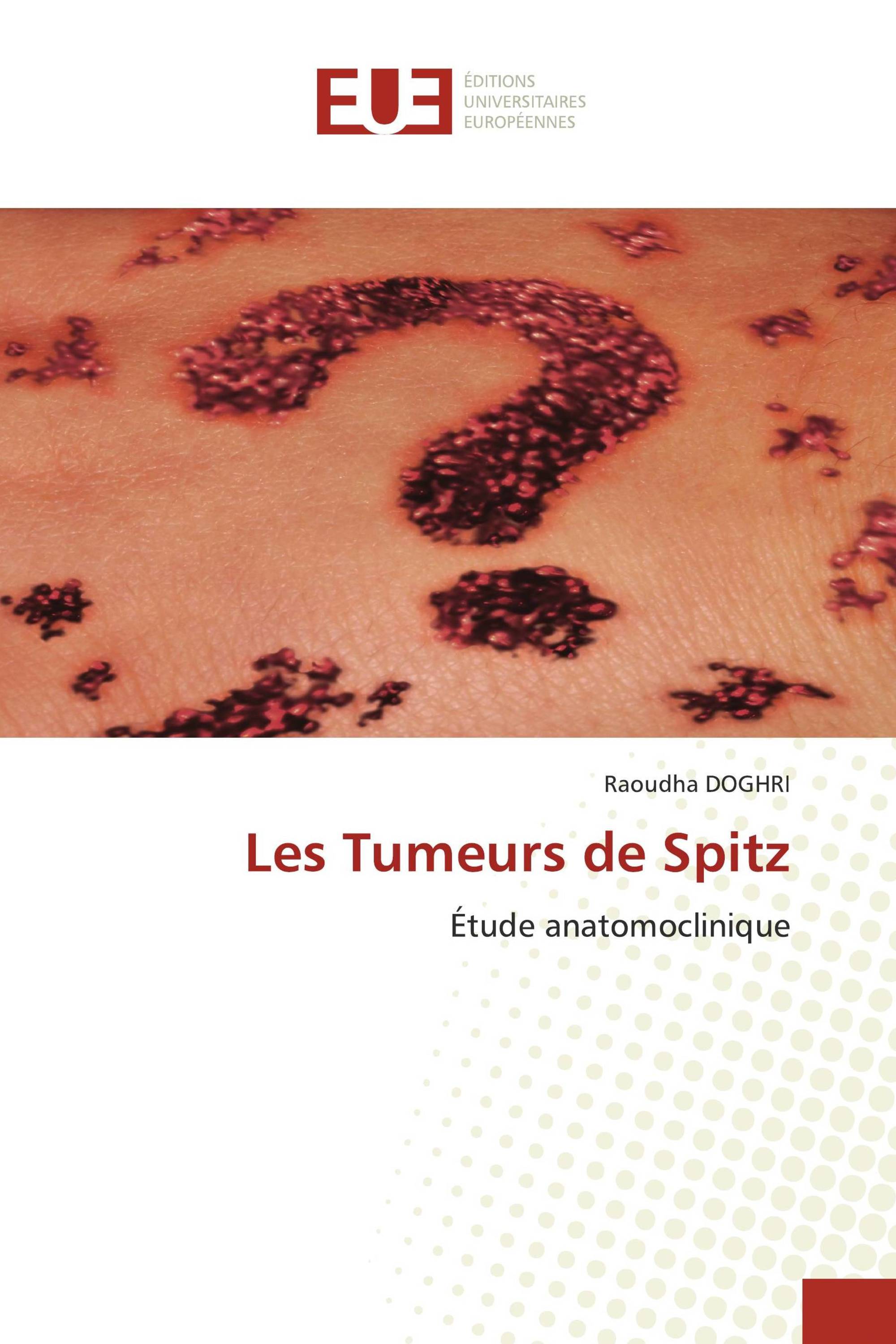 Les Tumeurs de Spitz