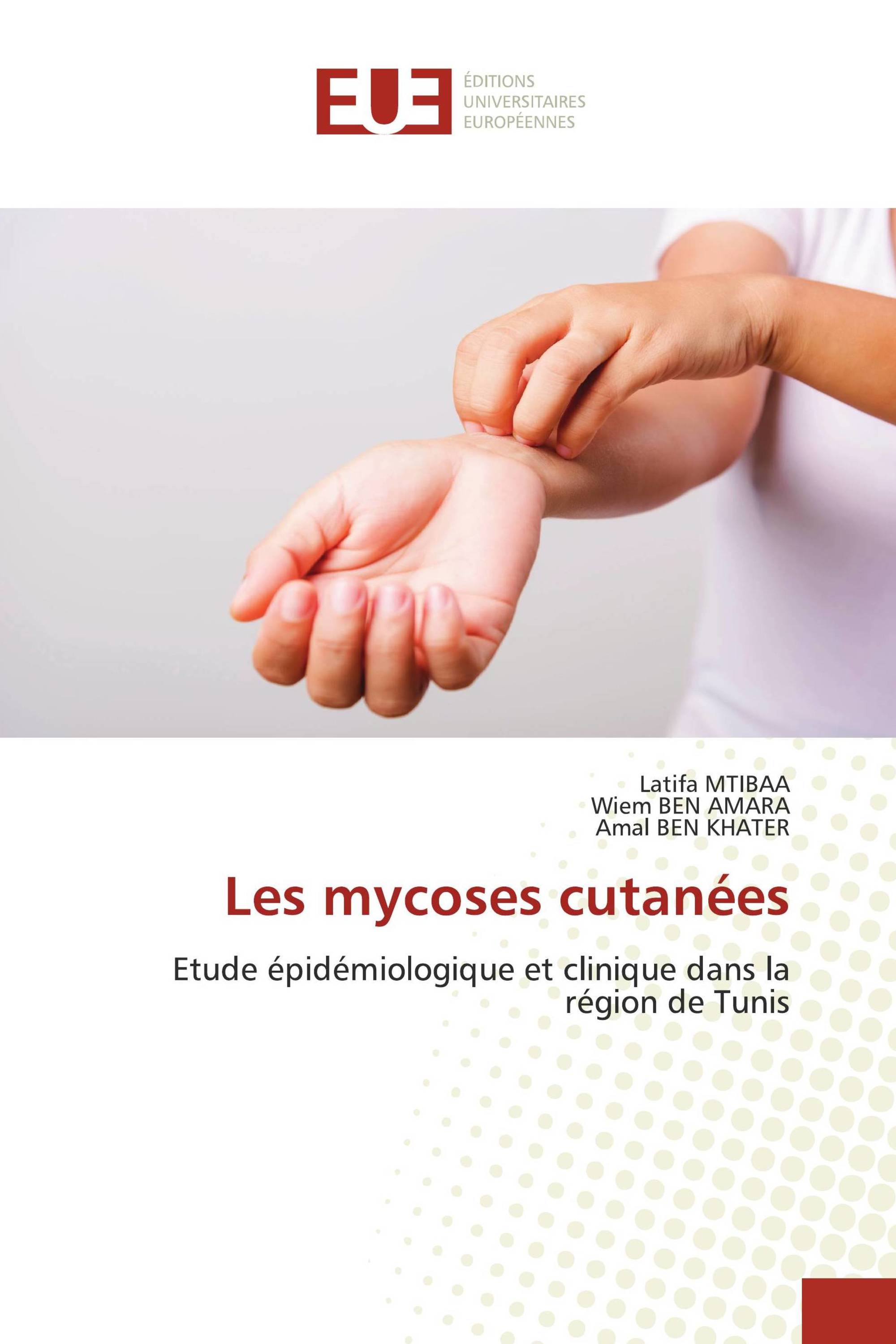 Les mycoses cutanées