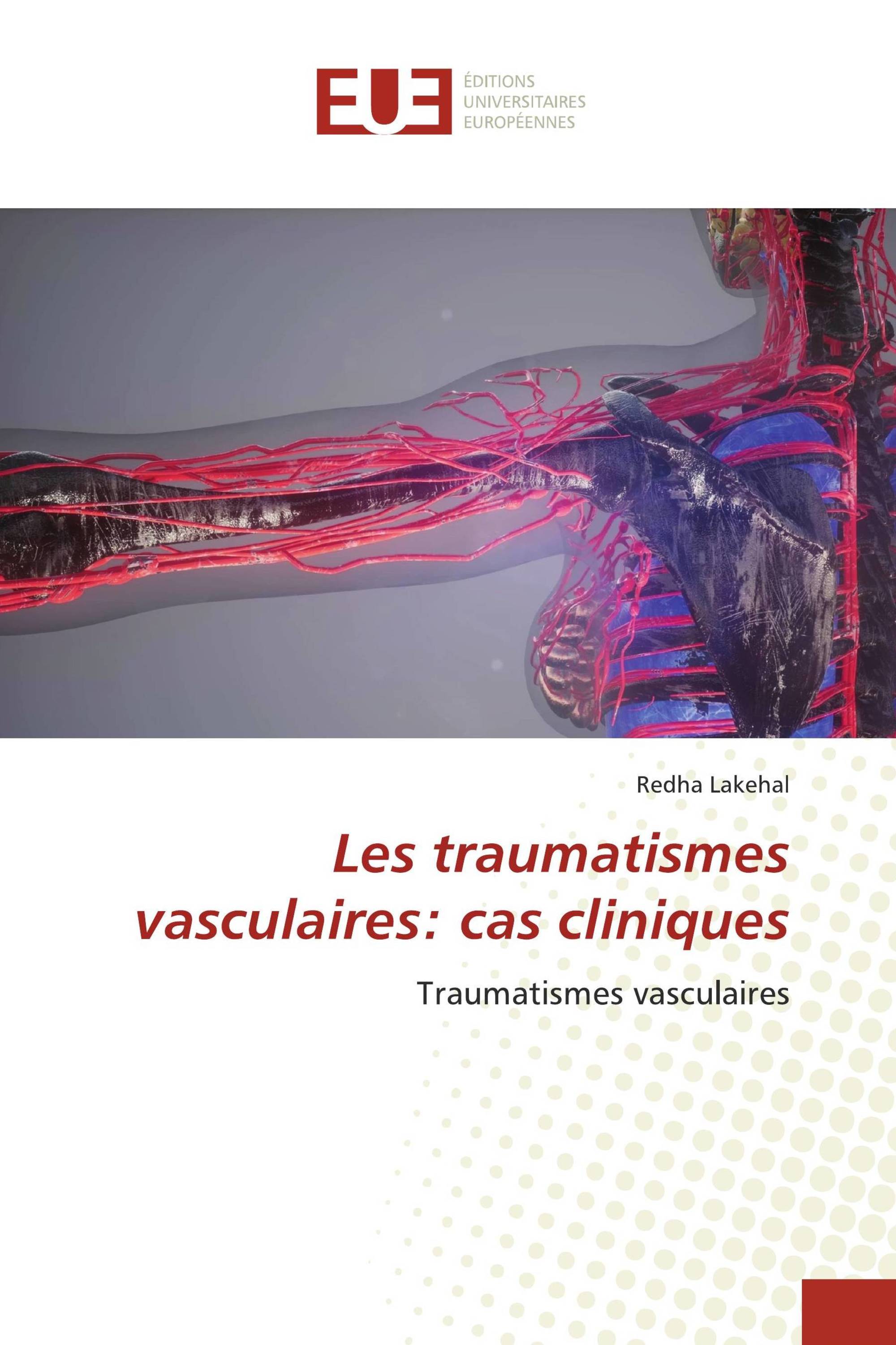 Les traumatismes vasculaires: cas cliniques