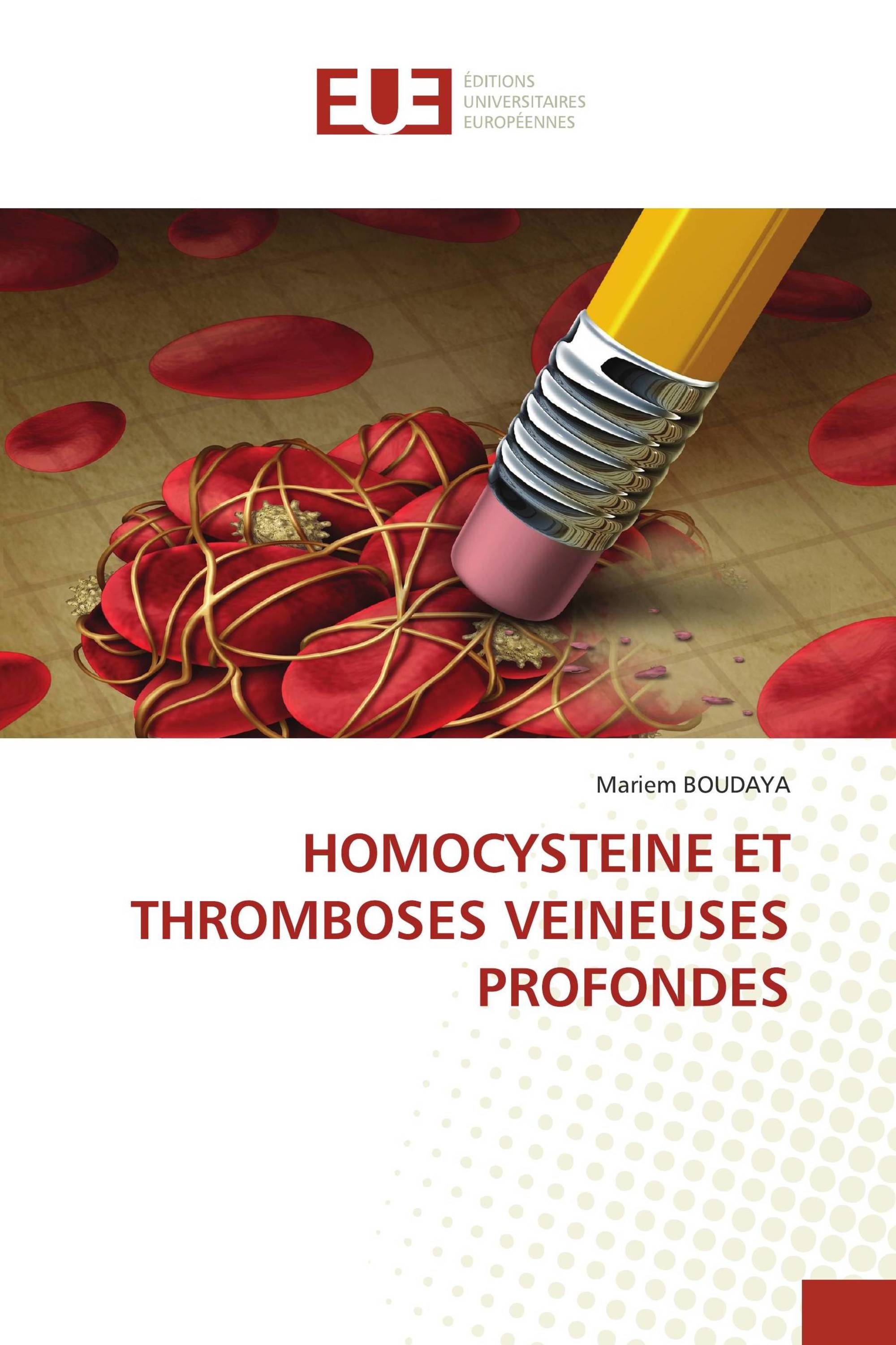 HOMOCYSTEINE ET THROMBOSES VEINEUSES PROFONDES