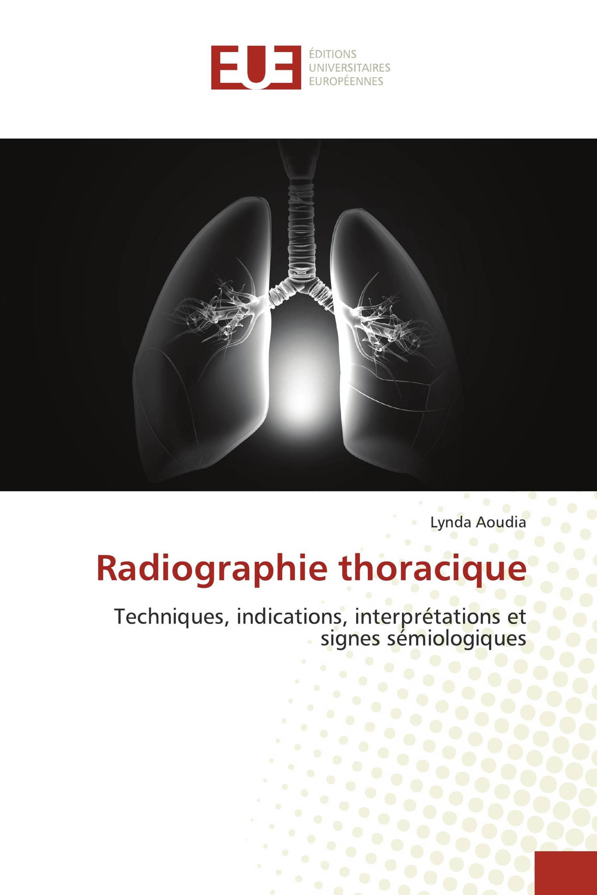 Radiographie thoracique