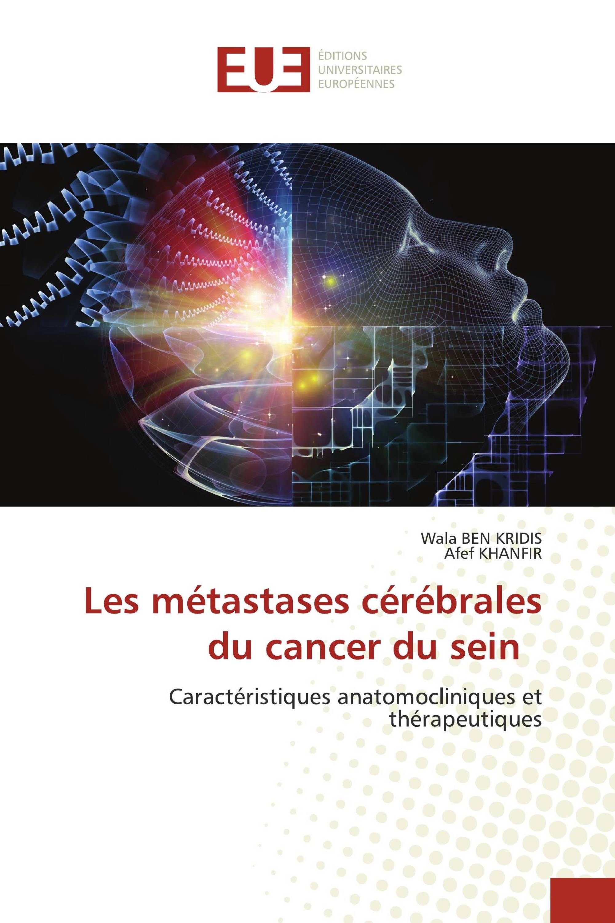 Les métastases cérébrales du cancer du sein