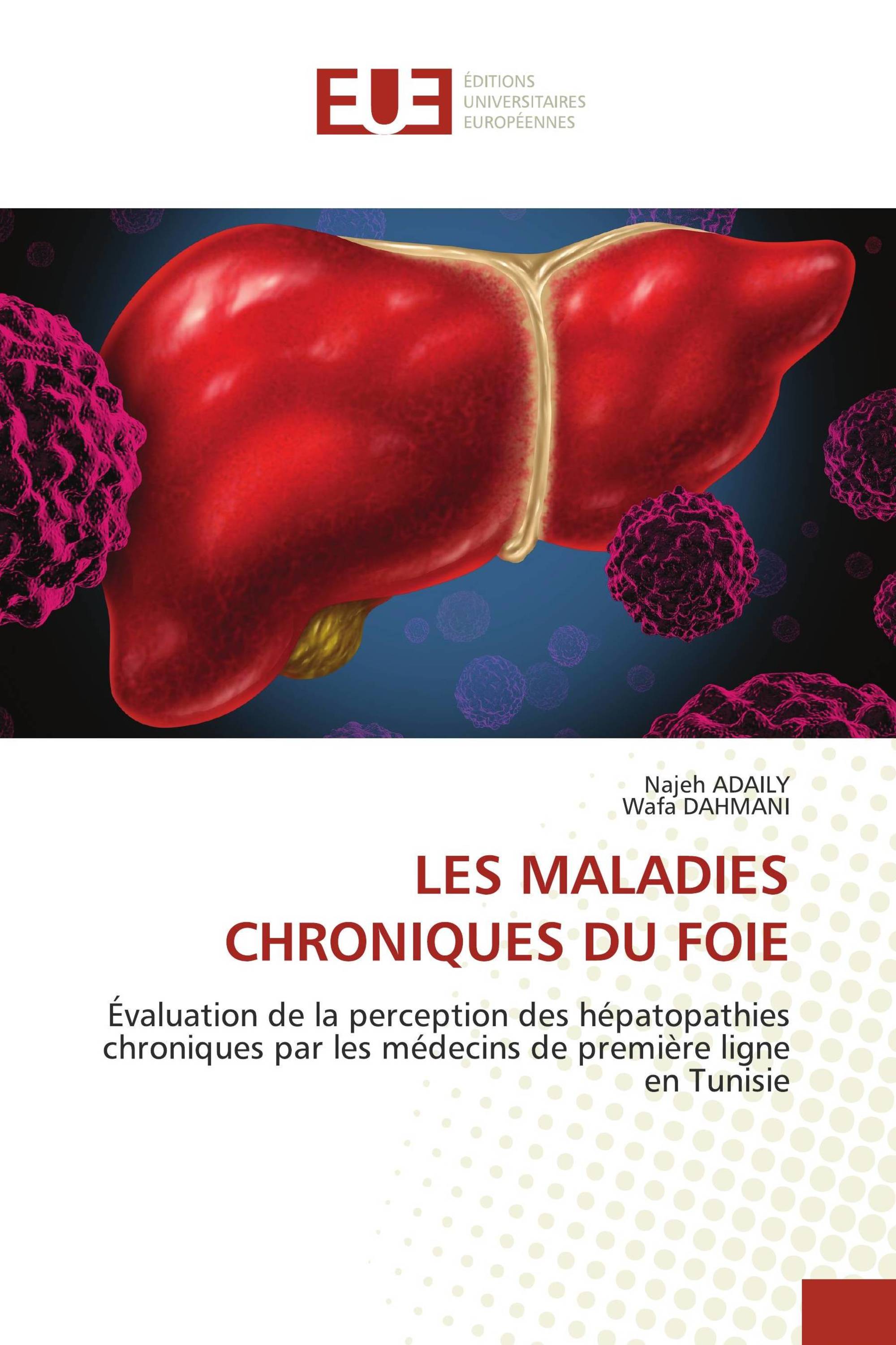 LES MALADIES CHRONIQUES DU FOIE