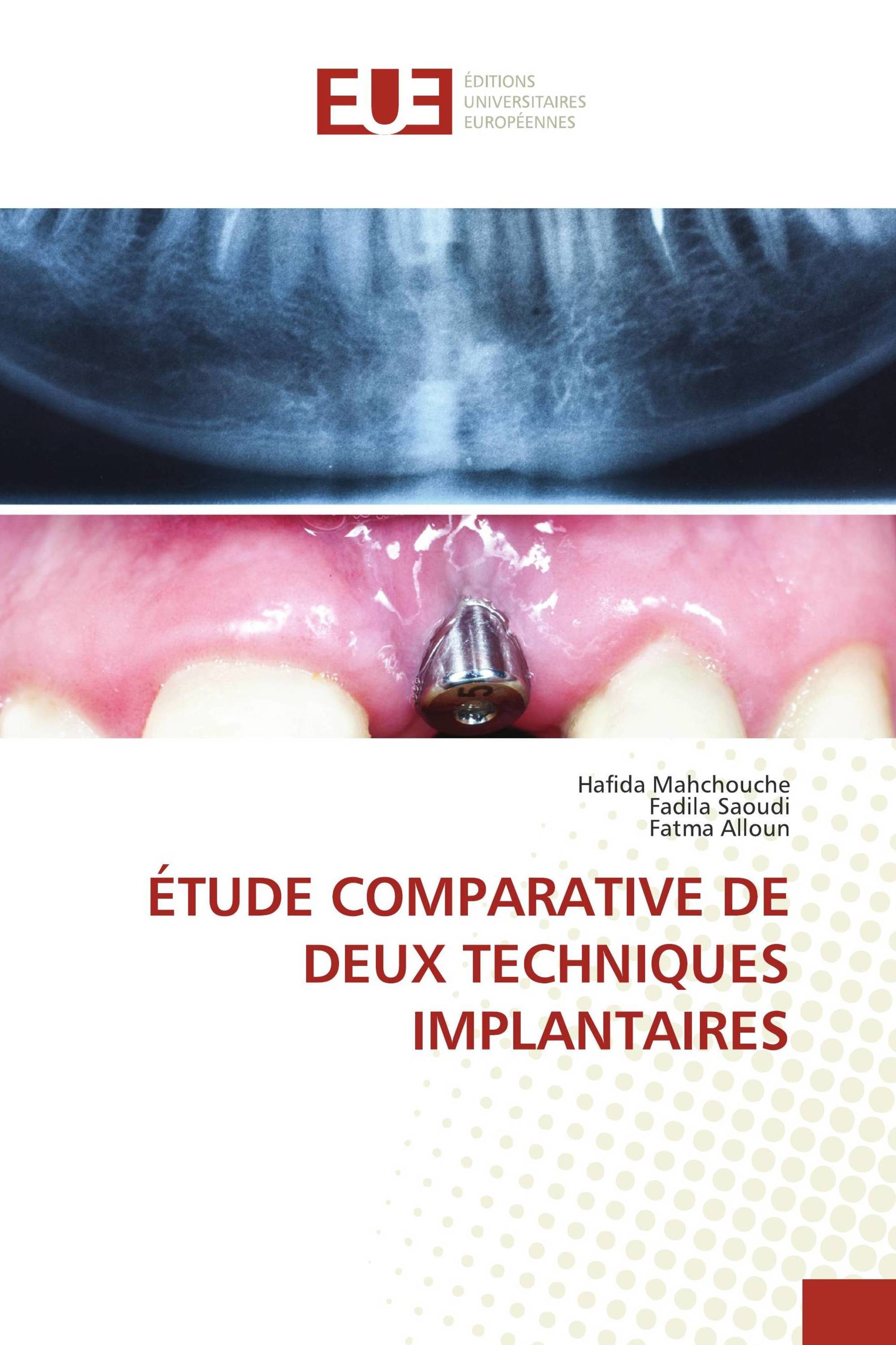 ÉTUDE COMPARATIVE DE DEUX TECHNIQUES IMPLANTAIRES