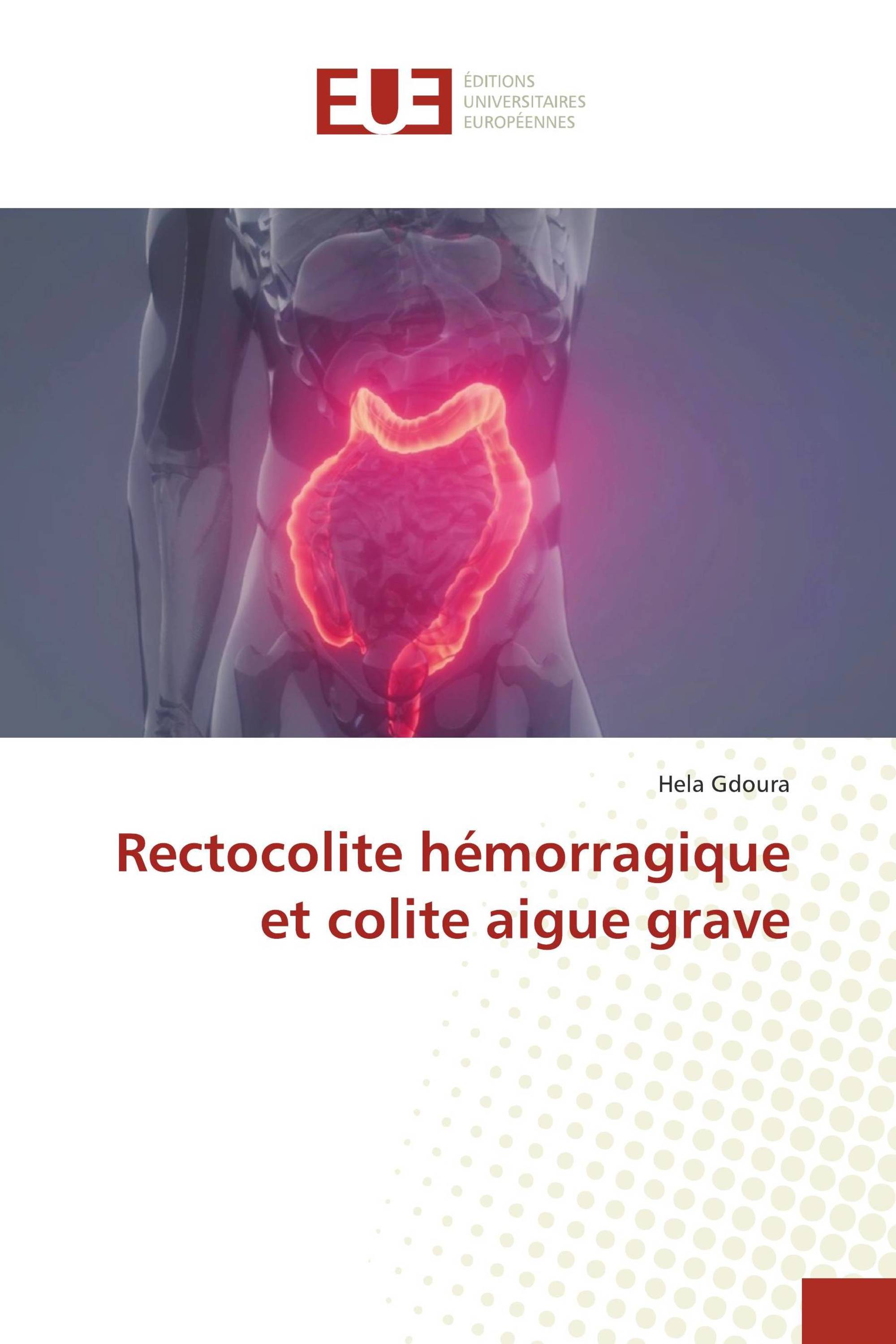 Rectocolite hémorragique et colite aigue grave