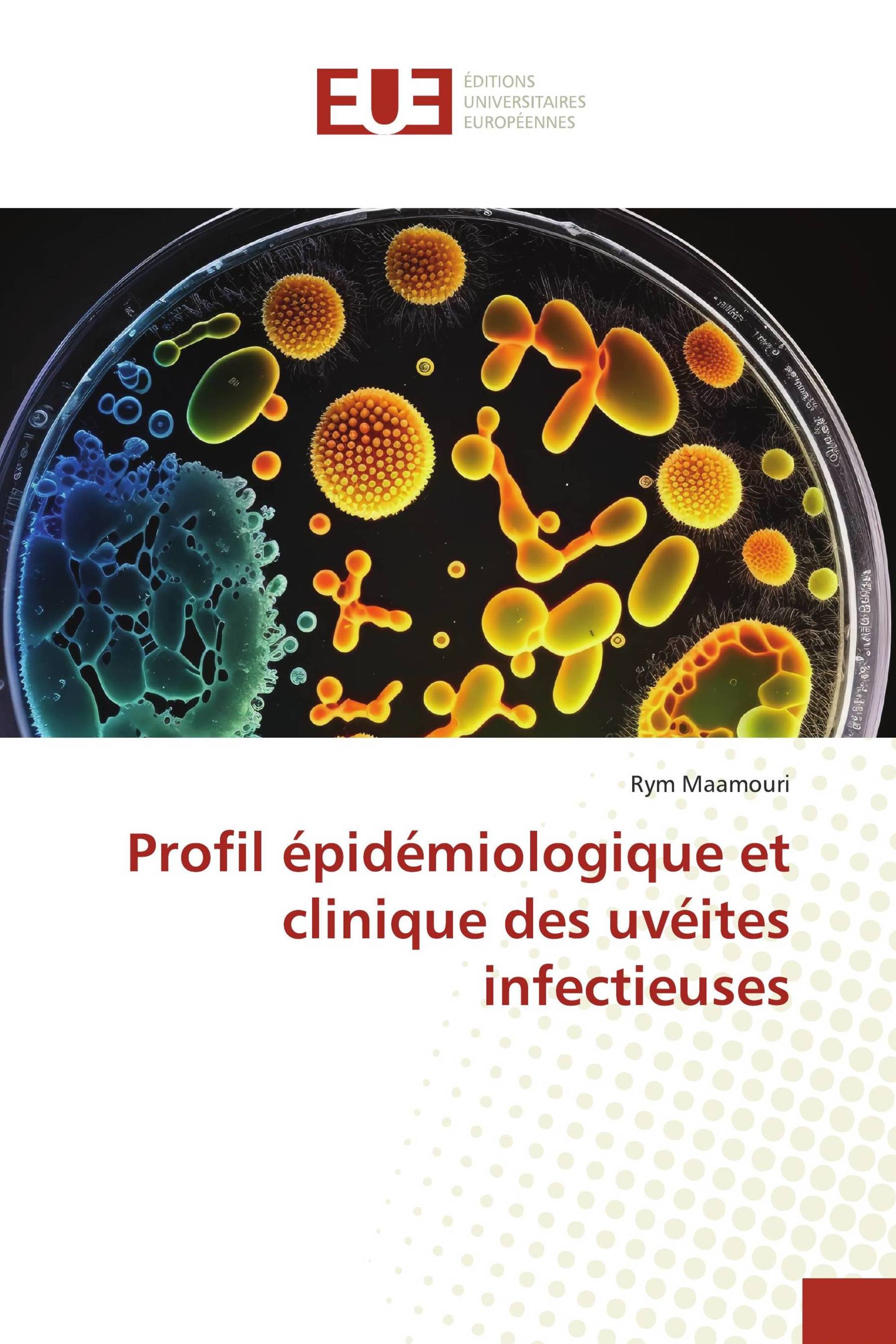 Profil épidémiologique et clinique des uvéites infectieuses