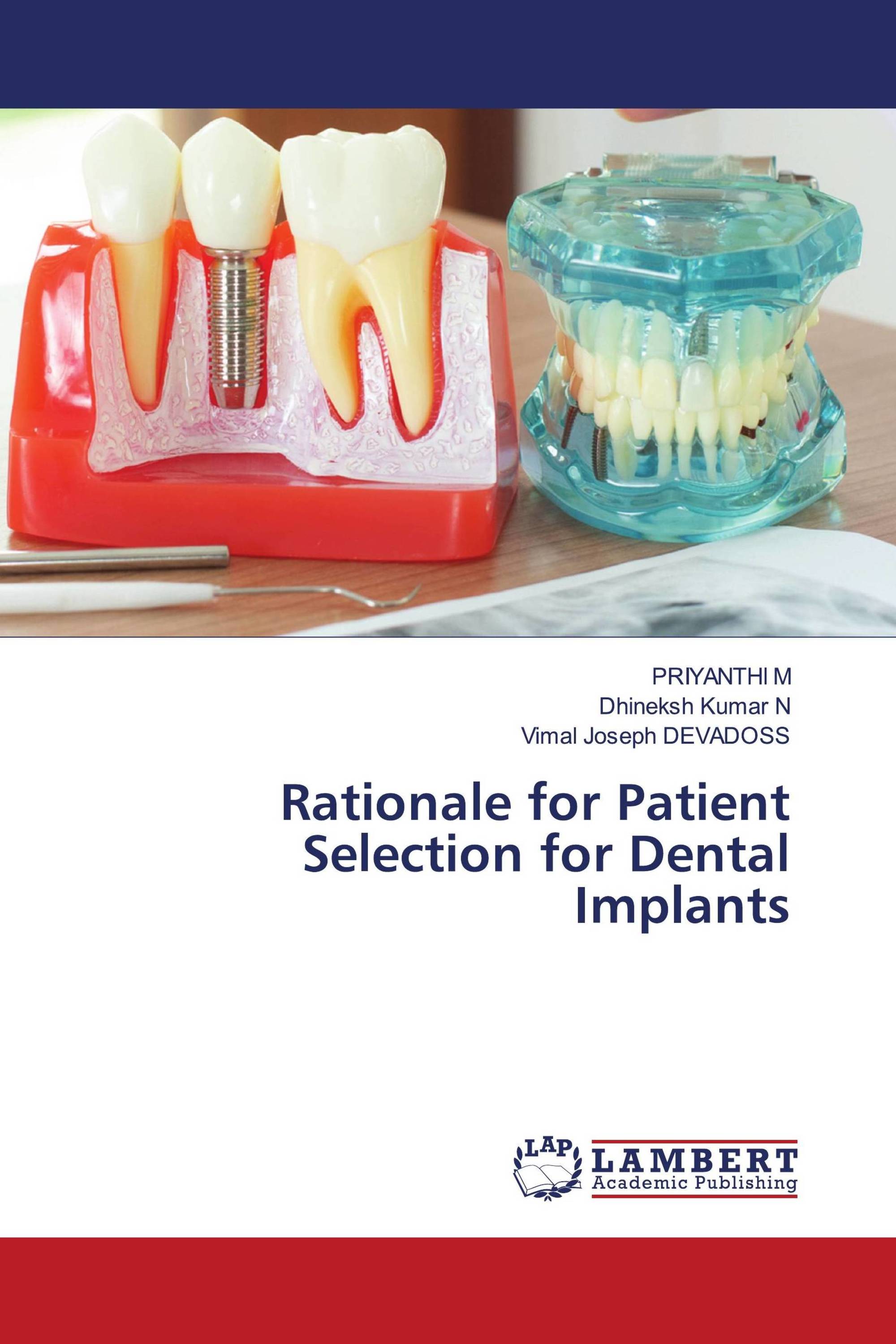 Rationale for Patient Selection for Dental Implants