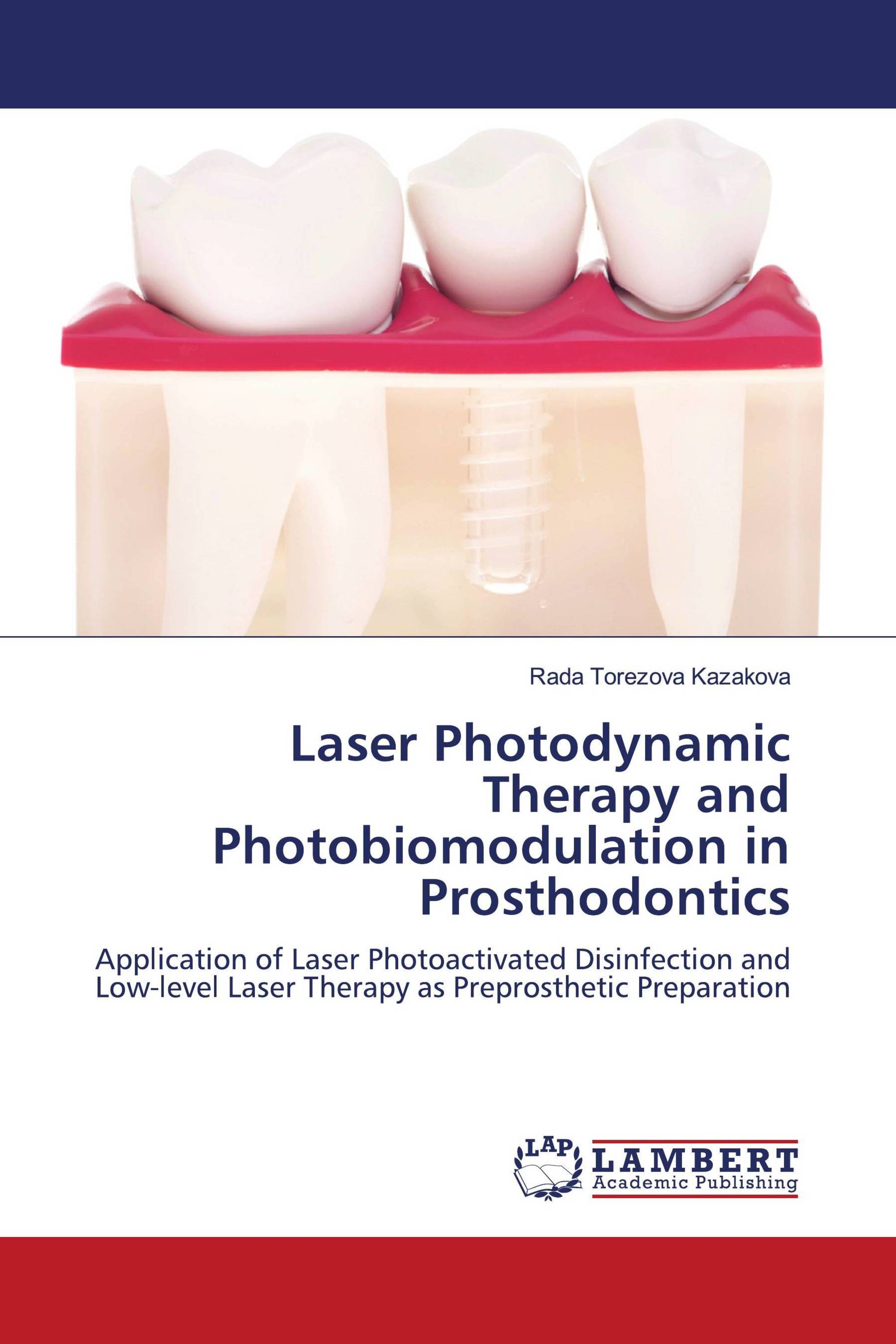 Laser Photodynamic Therapy and Photobiomodulation in Prosthodontics