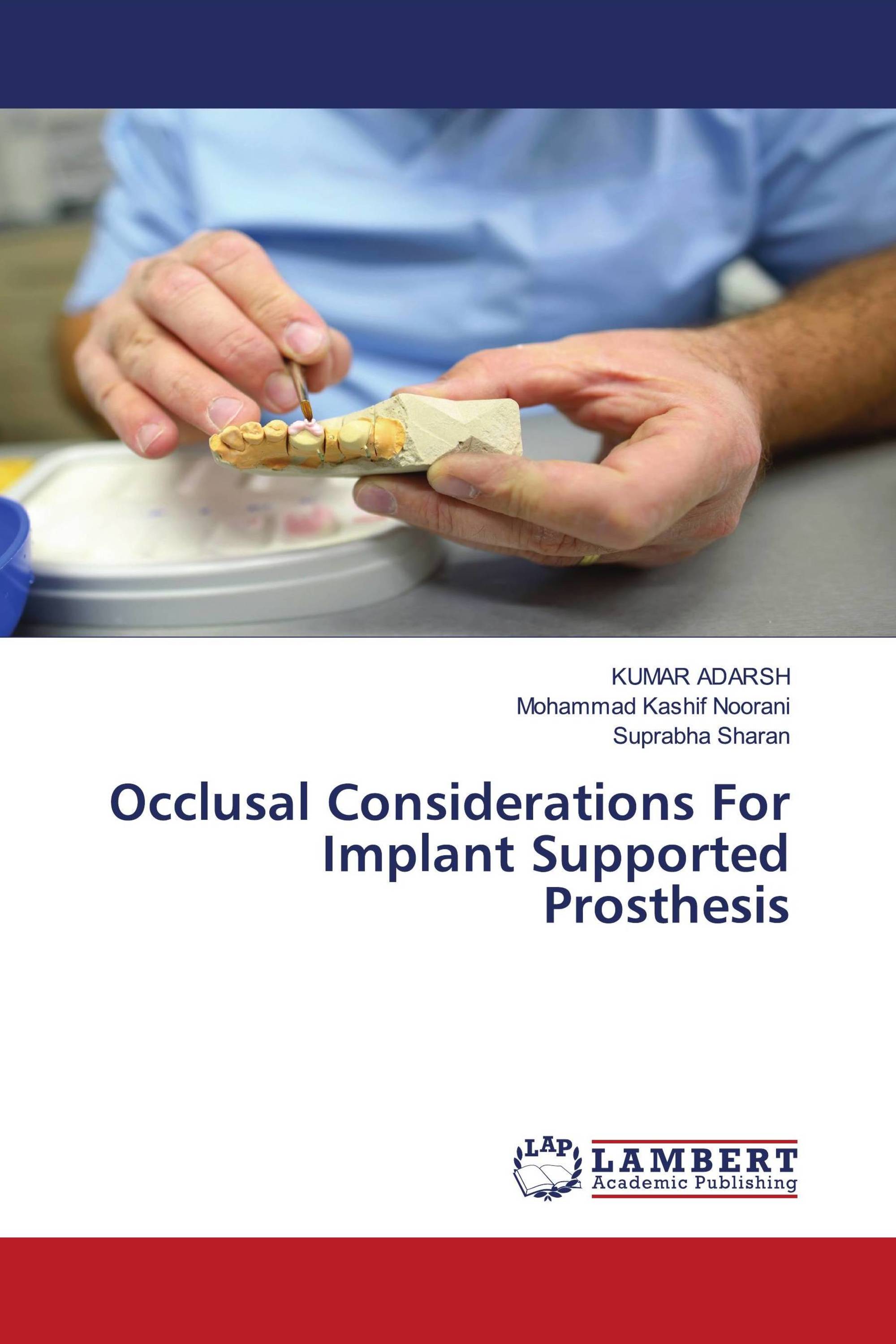Occlusal Considerations For Implant Supported Prosthesis / 9786203