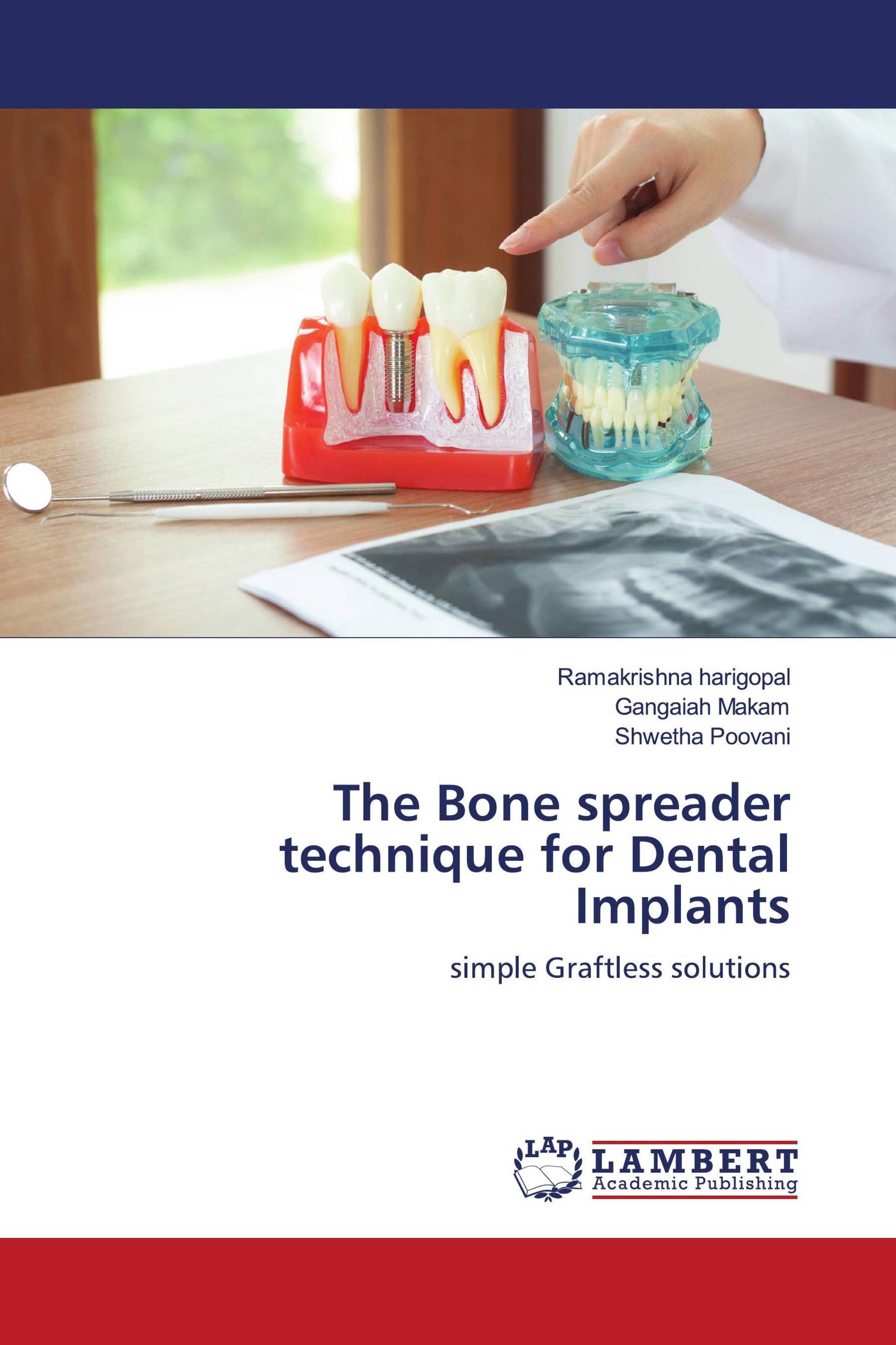 The Bone spreader technique for Dental Implants