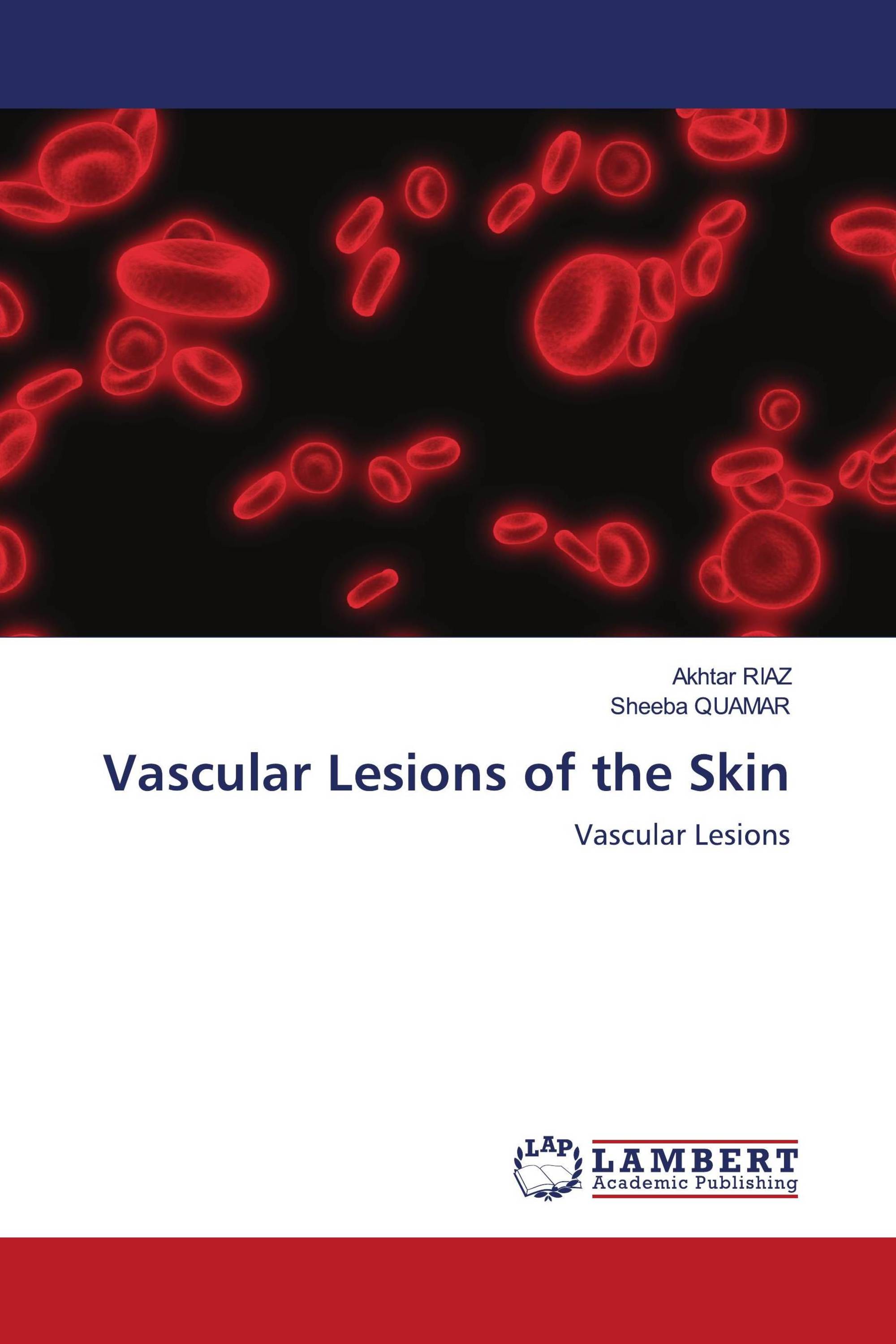 Vascular Lesions Of The Skin / 978-620-3-85743-6 / 9786203857436 ...