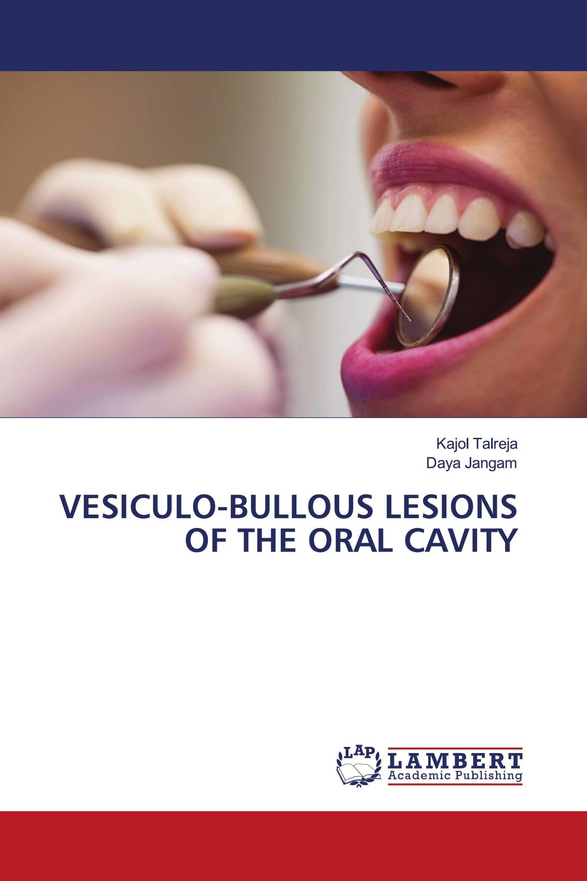 VESICULO-BULLOUS LESIONS OF THE ORAL CAVITY