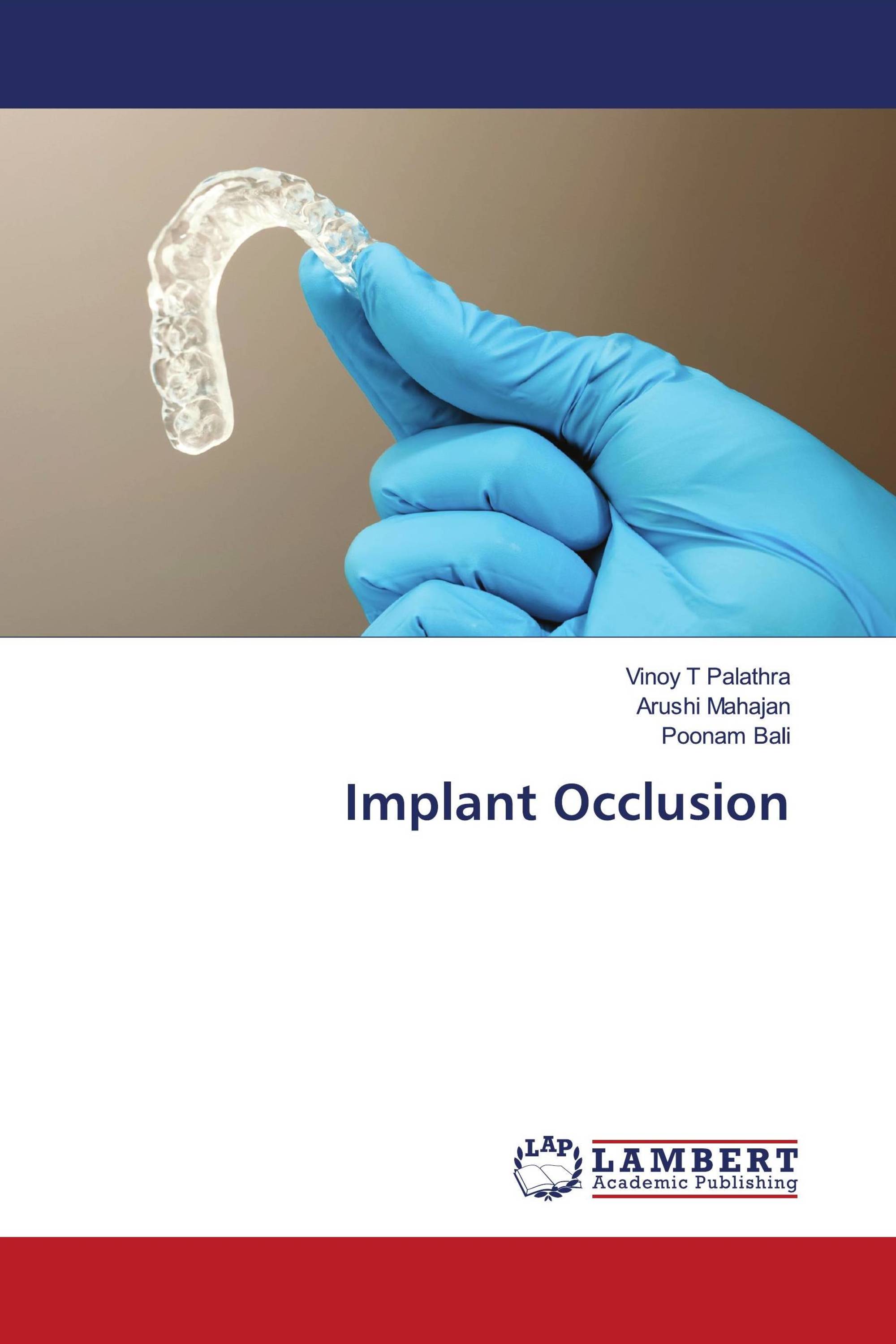 Implant Occlusion / 978-620-3-92668-2 / 9786203926682 / 620392668X