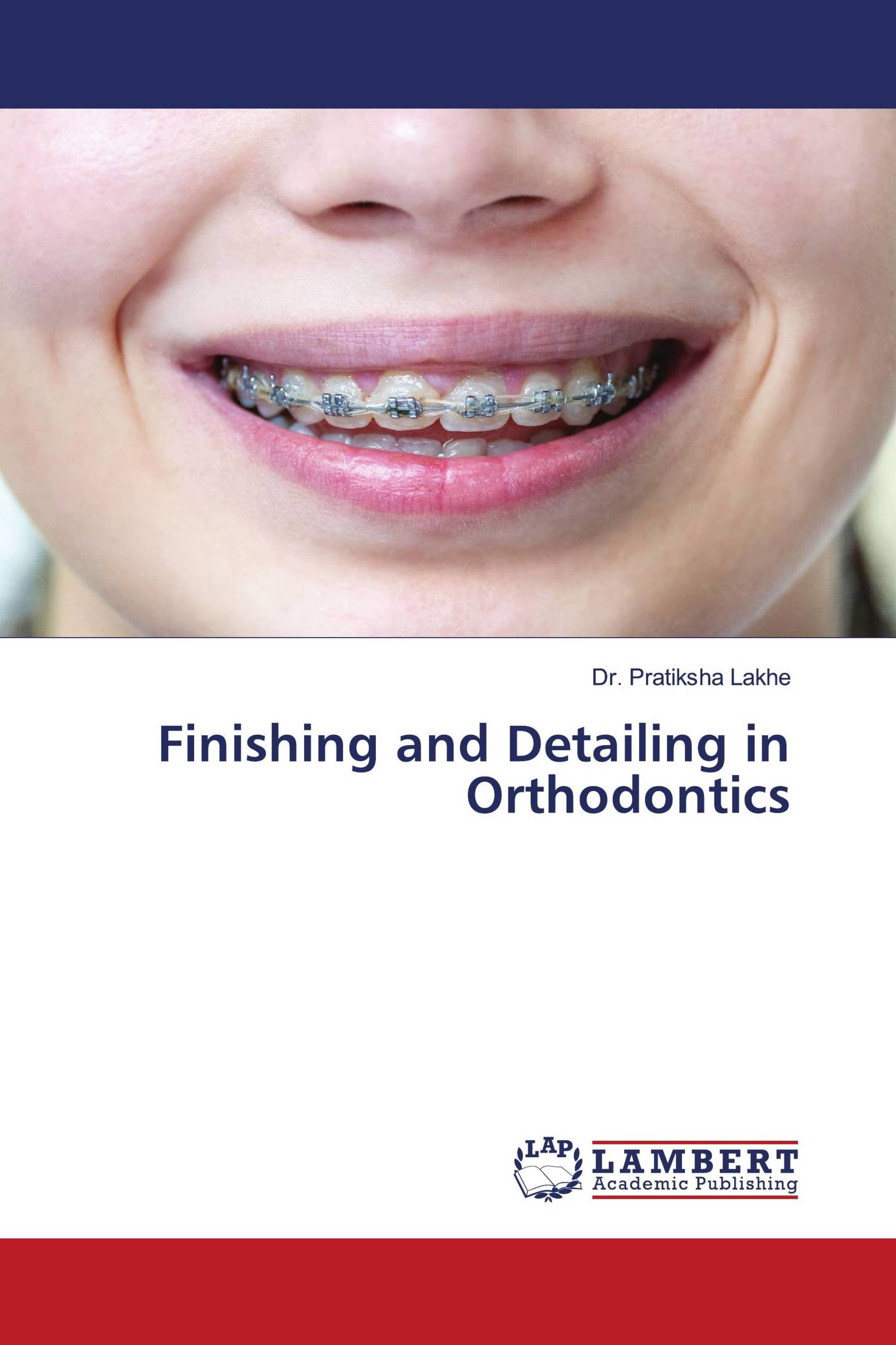 Finishing and Detailing in Orthodontics