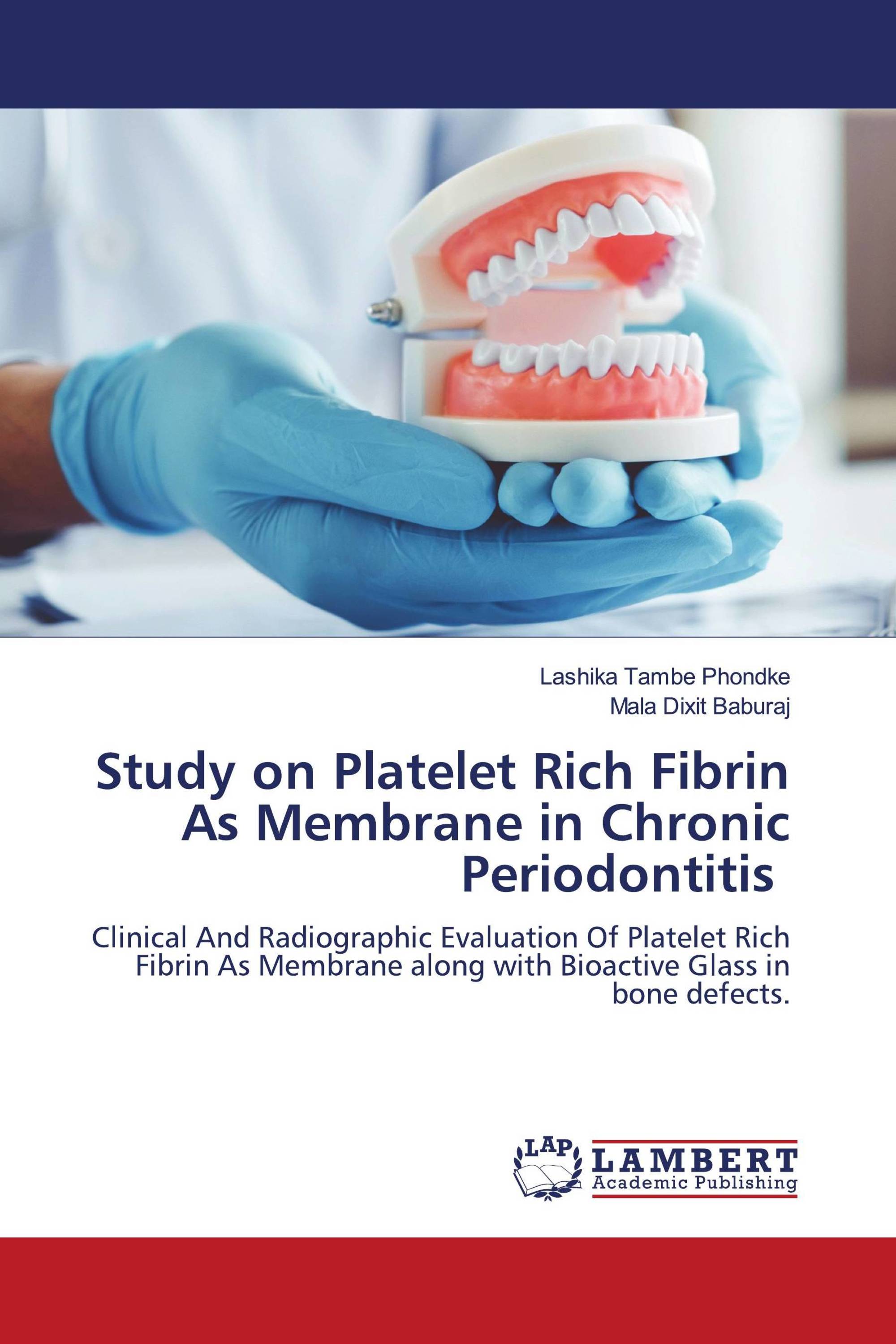 Study On Platelet Rich Fibrin As Membrane In Chronic Periodontitis