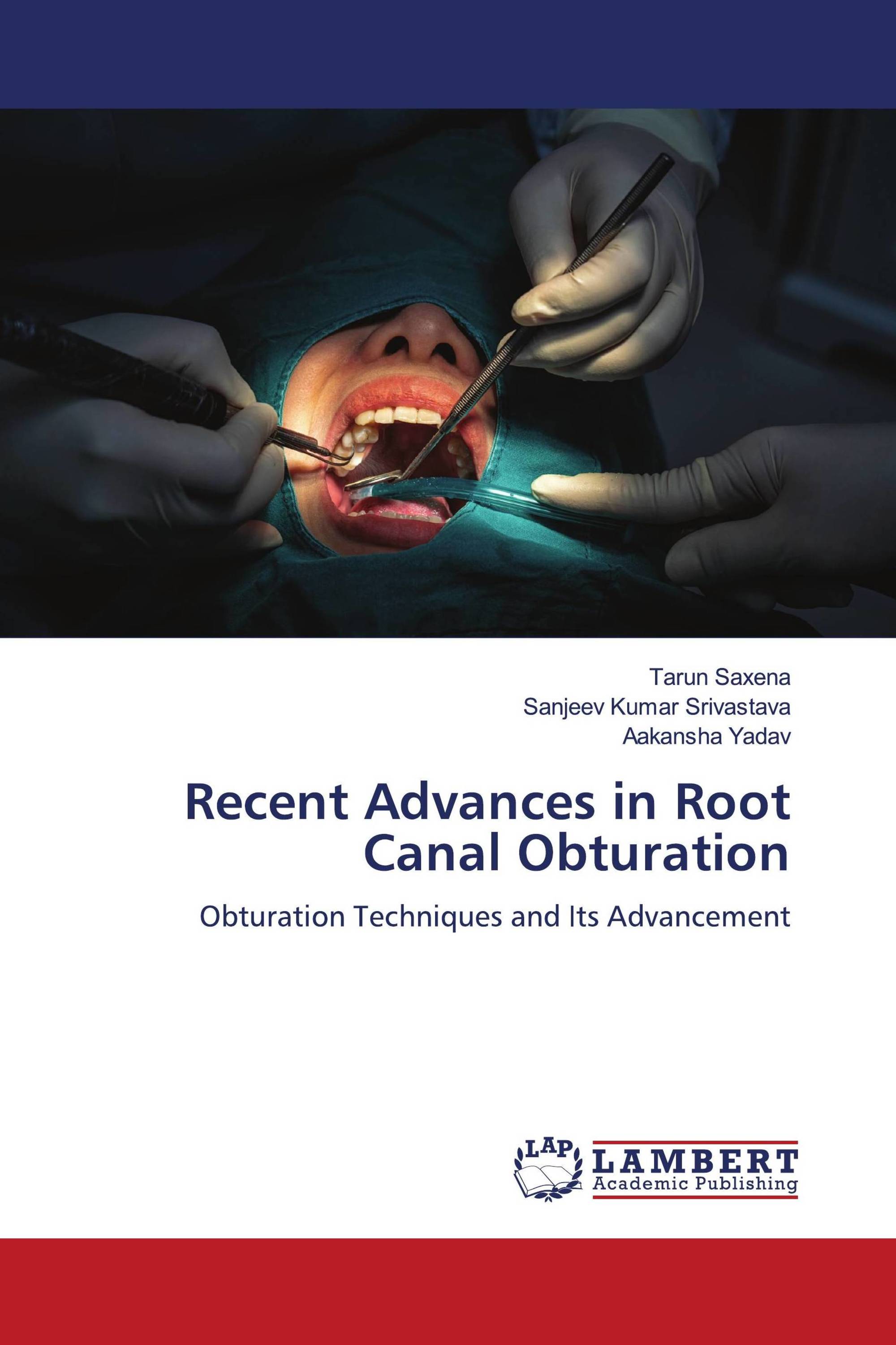 Recent Advances in Root Canal Obturation / 9786204213873