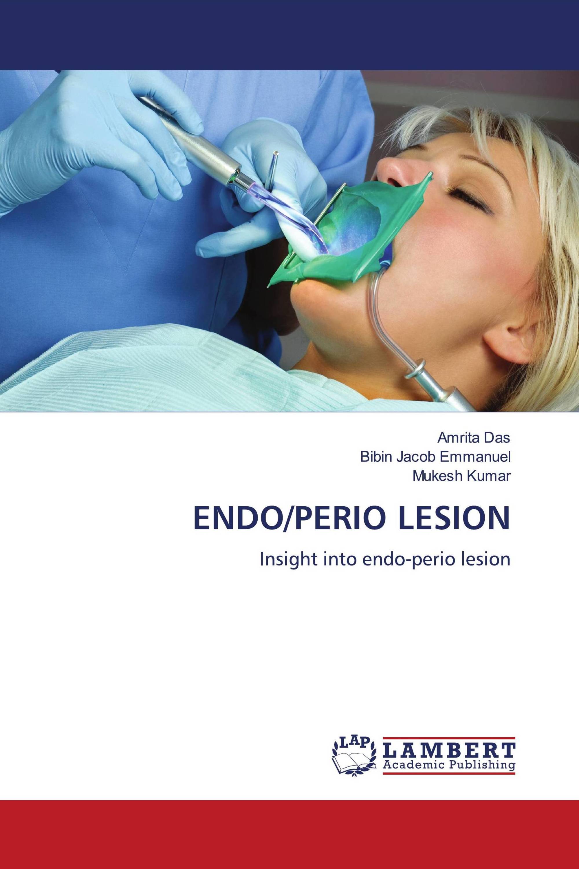 ENDO/PERIO LESION / 9786204725253 / 9786204725253 / 6204725254