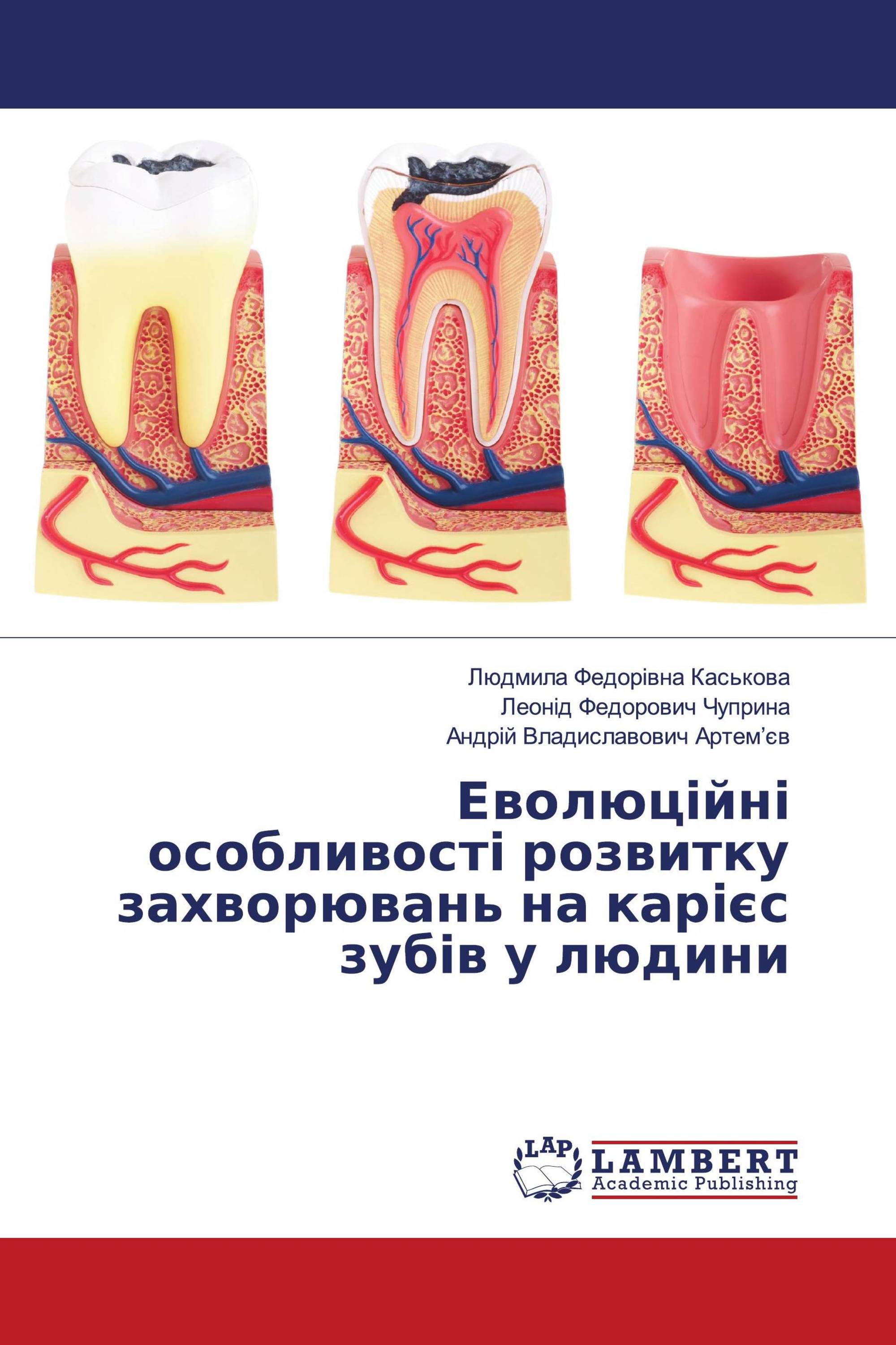 Еволюційні особливості розвитку захворювань на карієс зубів у людини