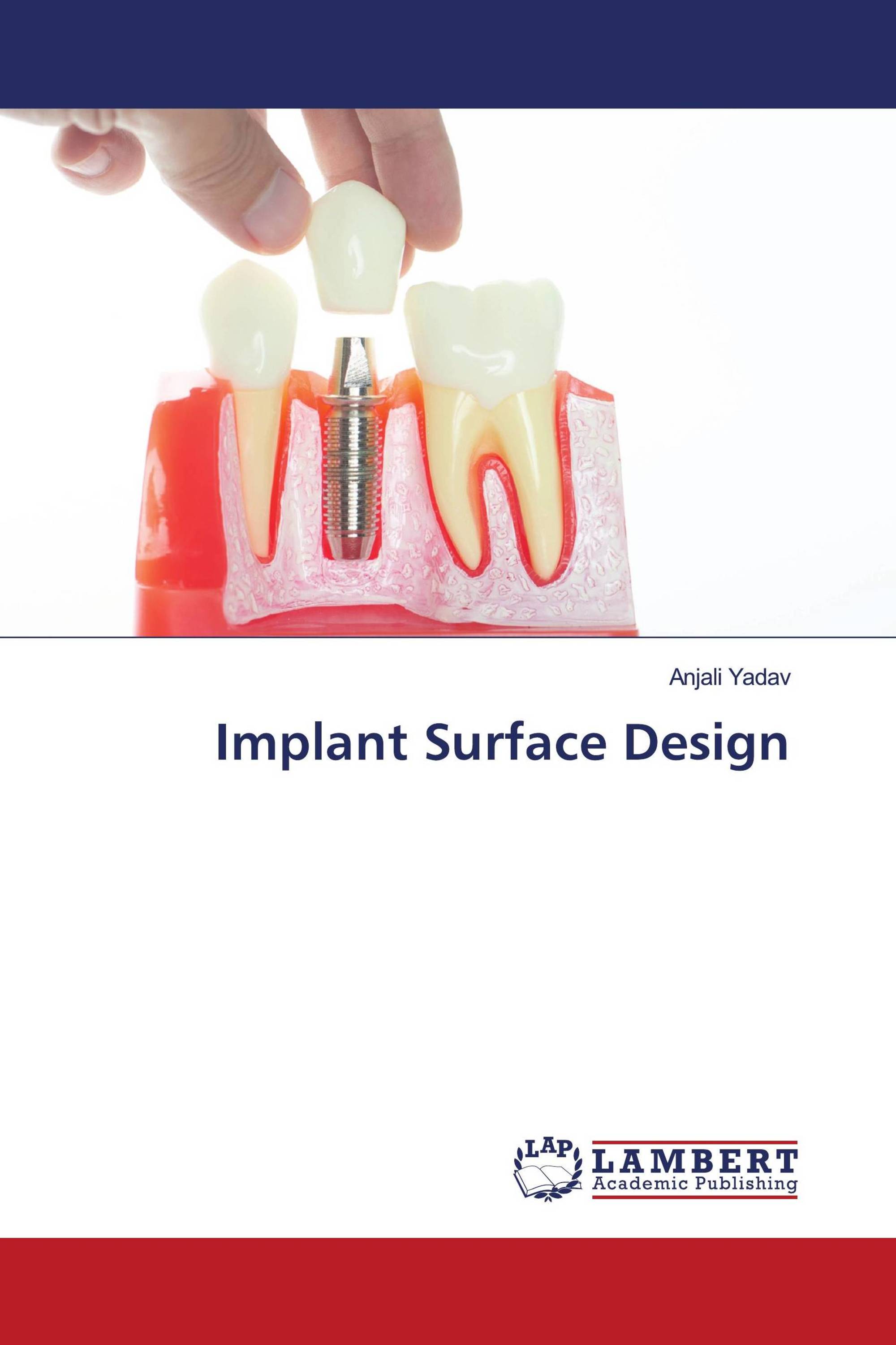 Implant Surface Design