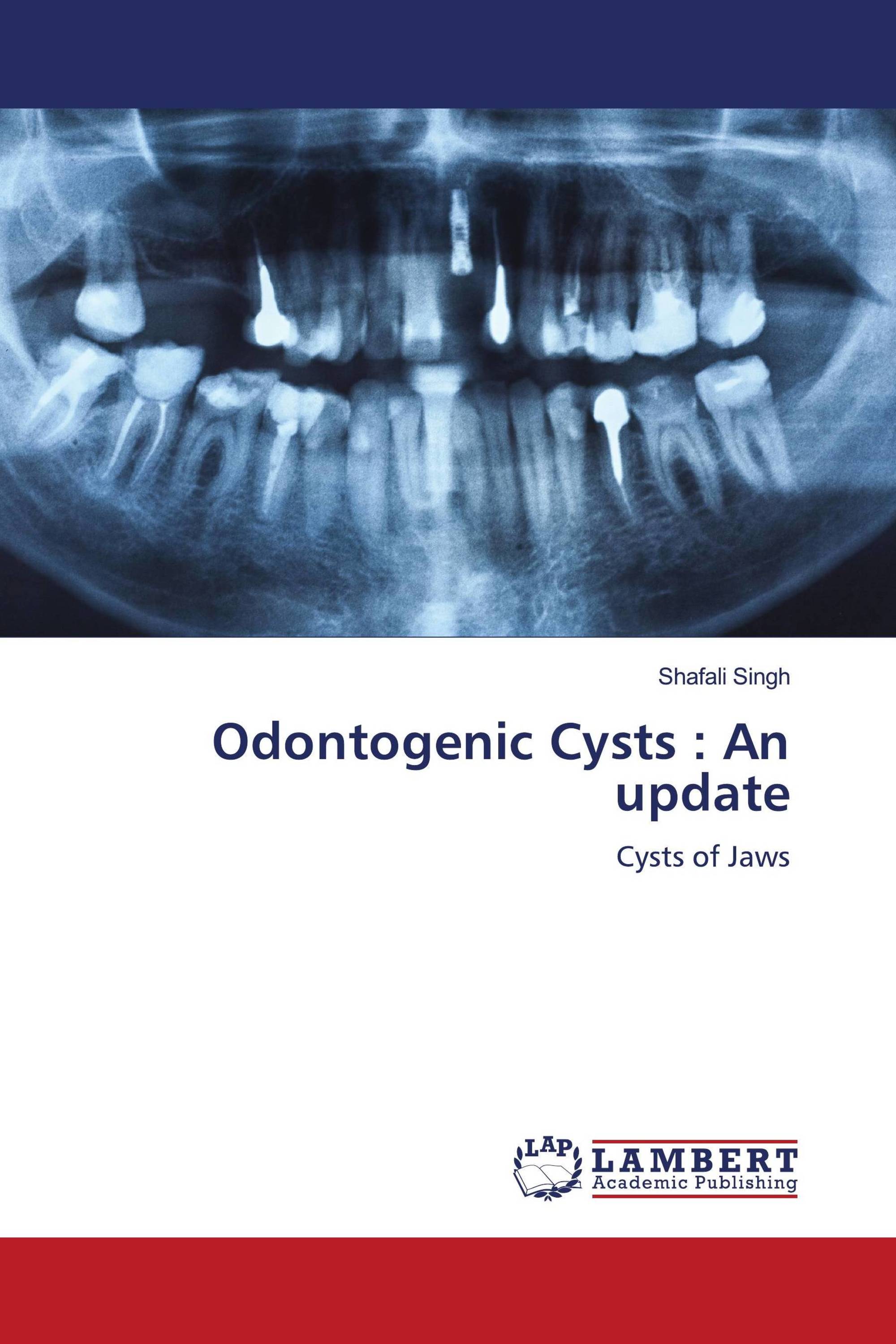 Odontogenic Cysts : An update