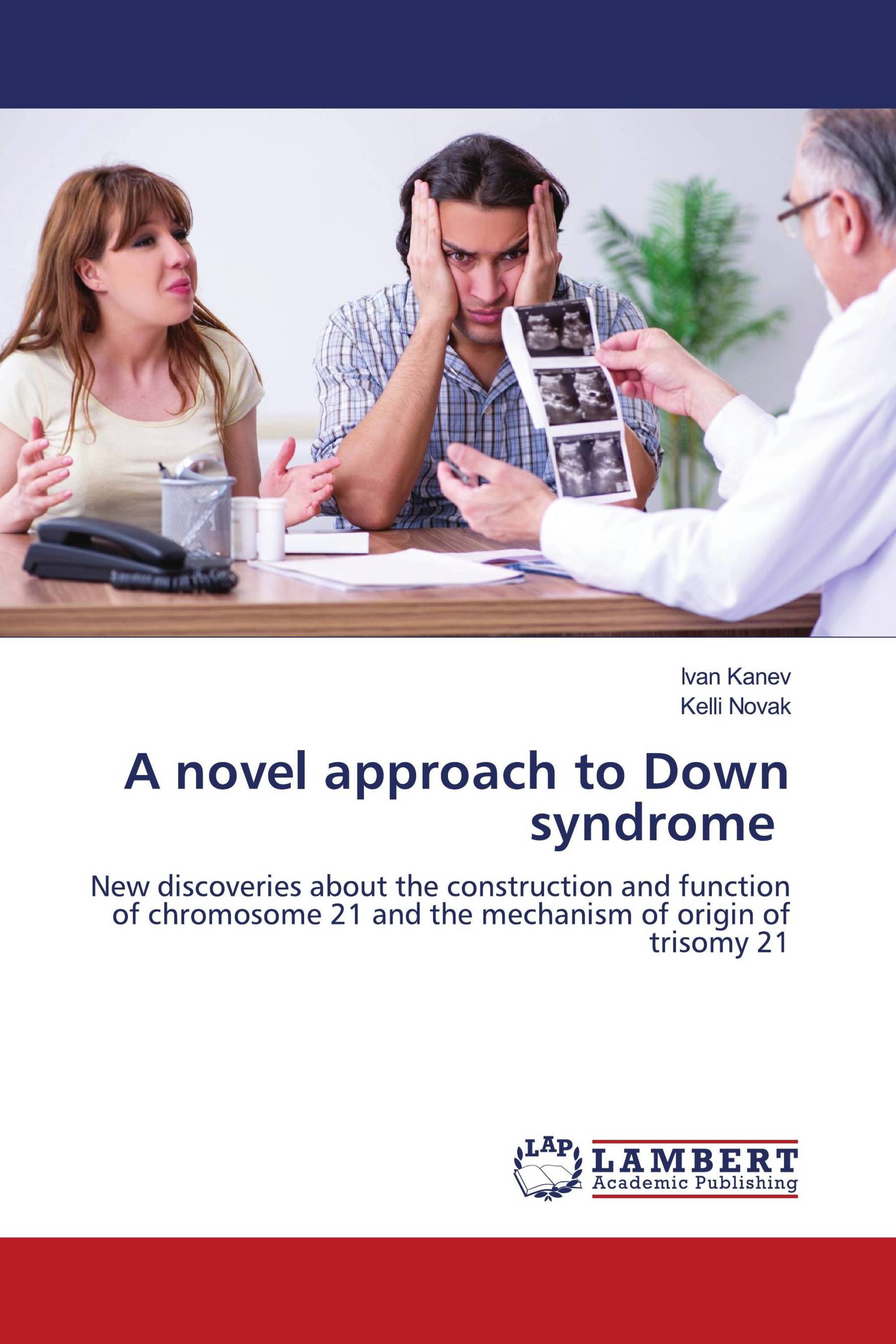 literature review on down syndrome