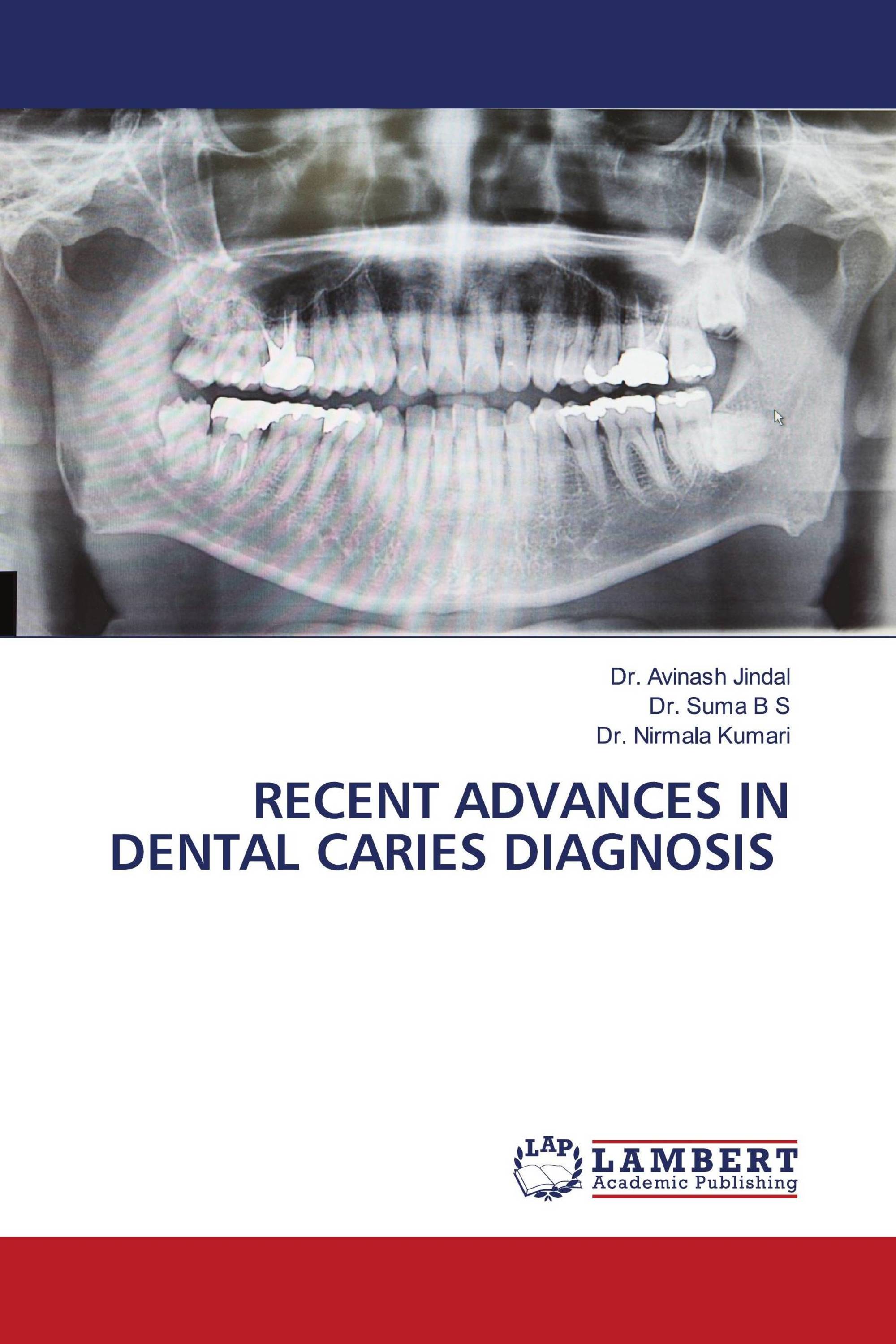 RECENT ADVANCES IN DENTAL CARIES DIAGNOSIS / 9786204748009