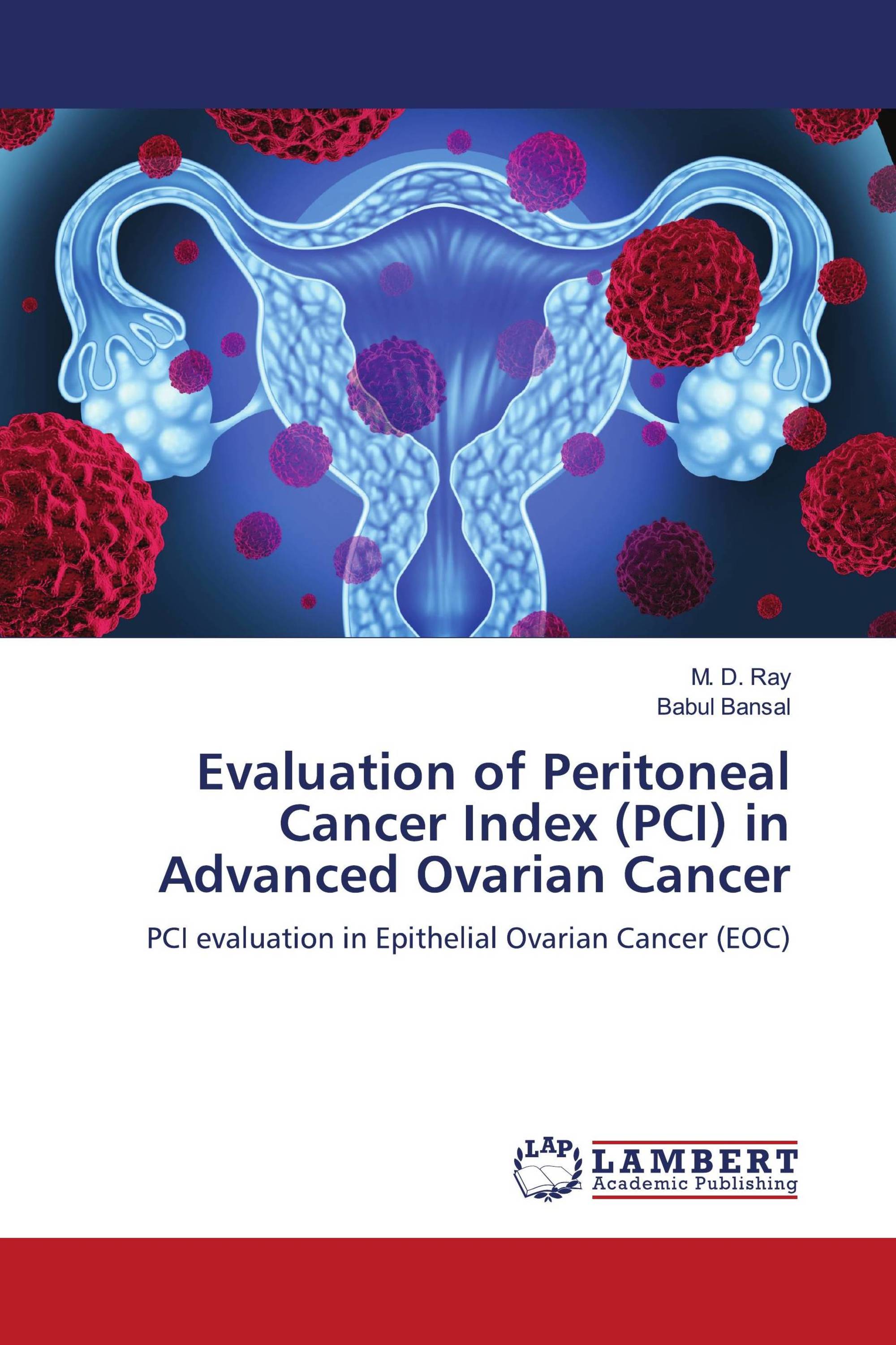 Evaluation of Peritoneal Cancer Index (PCI) in Advanced Ovarian Cancer ...