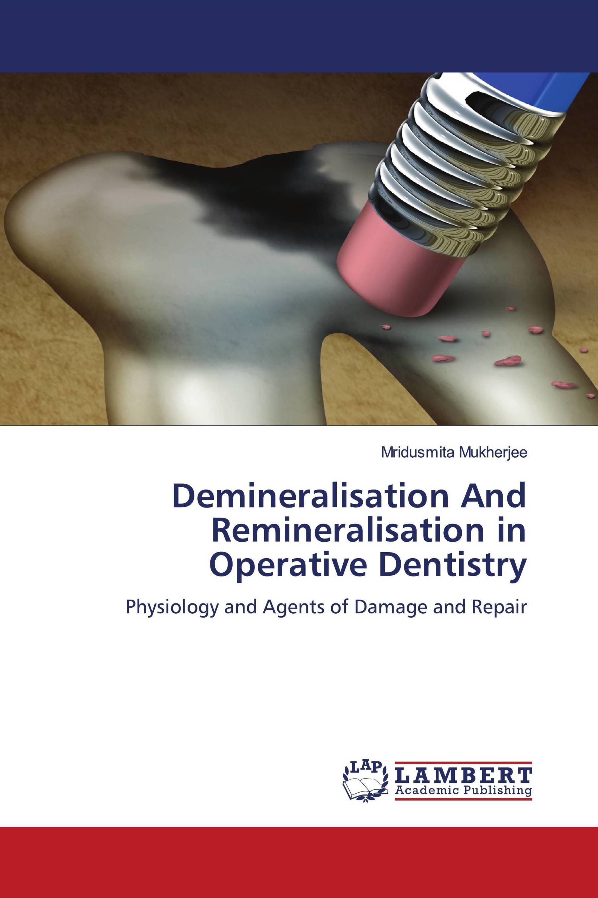 Demineralisation And Remineralisation in Operative Dentistry / 978-620 ...