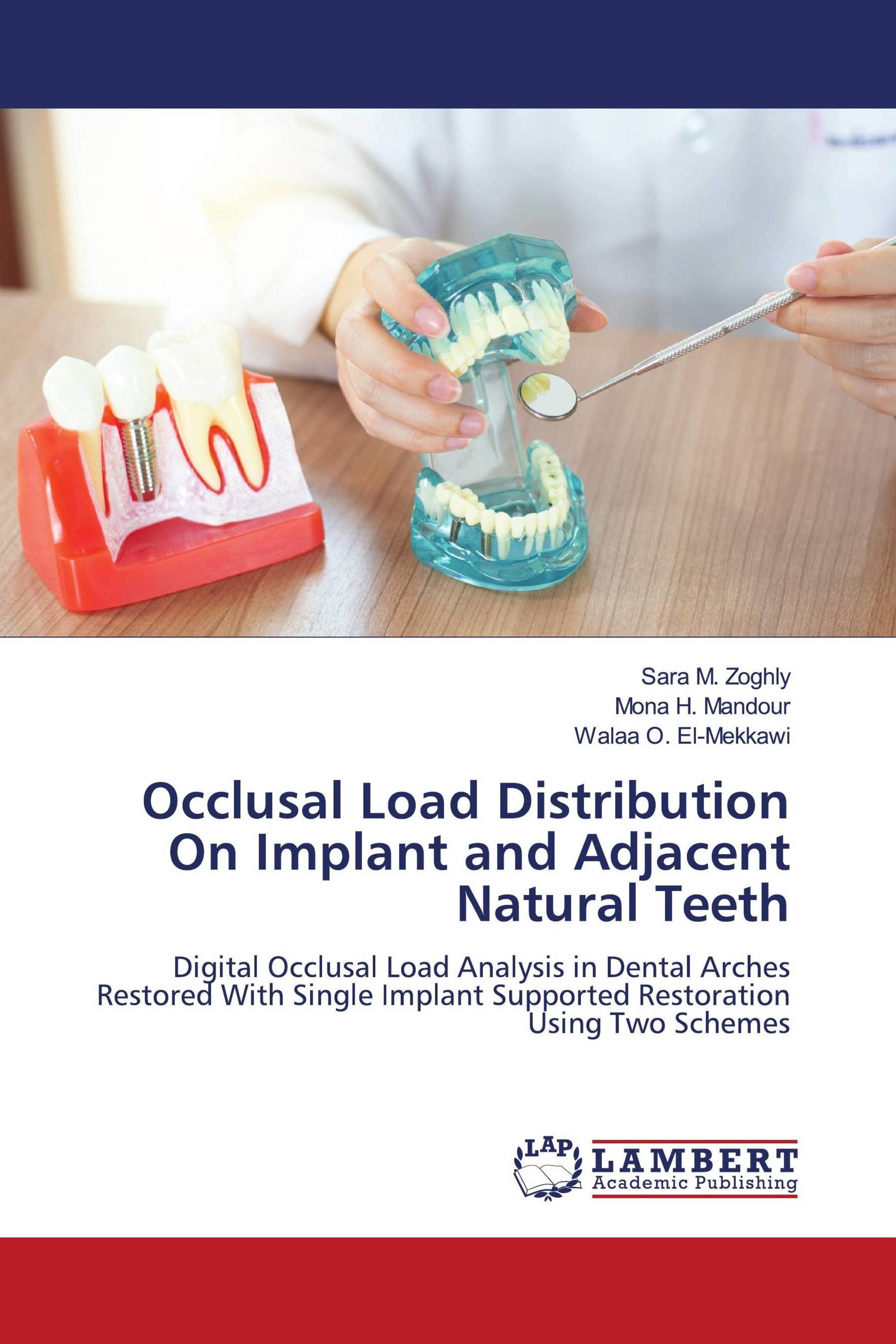 Occlusal Load Distribution On Implant and Adjacent Natural Teeth / 978