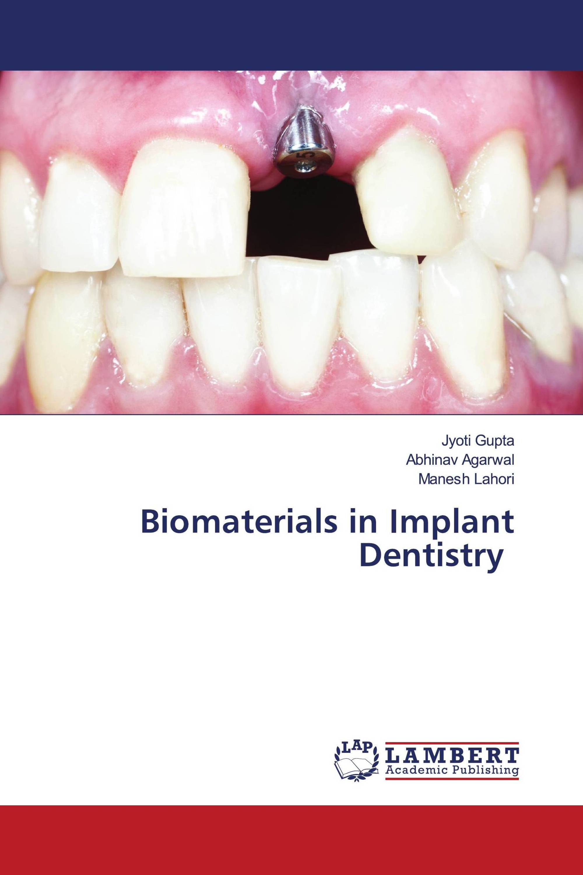 Biomaterials in Implant Dentistry / 9786204979939 / 9786204979939