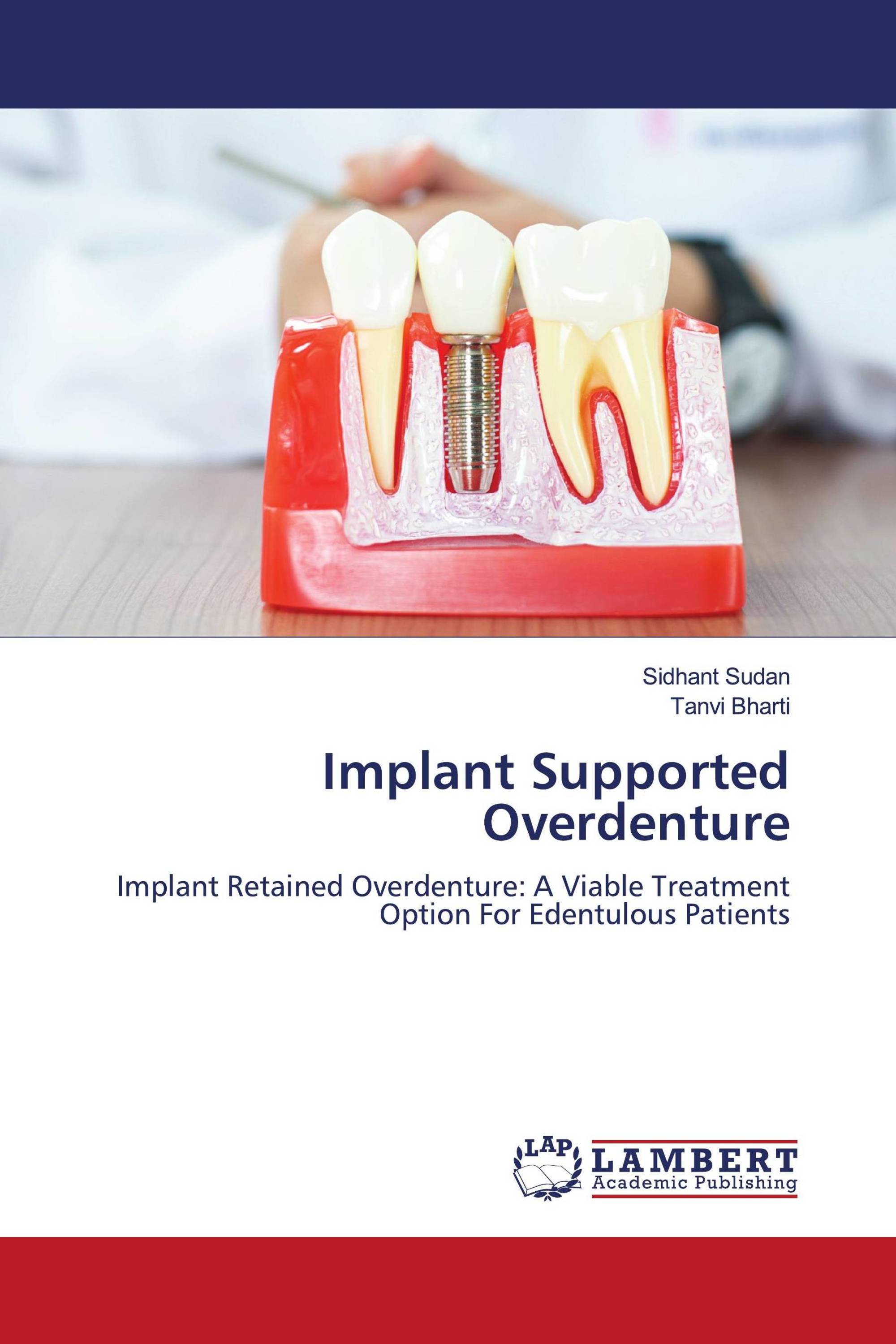 Implant Supported Overdenture / 978-620-5-48798-3 / 9786205487983 ...