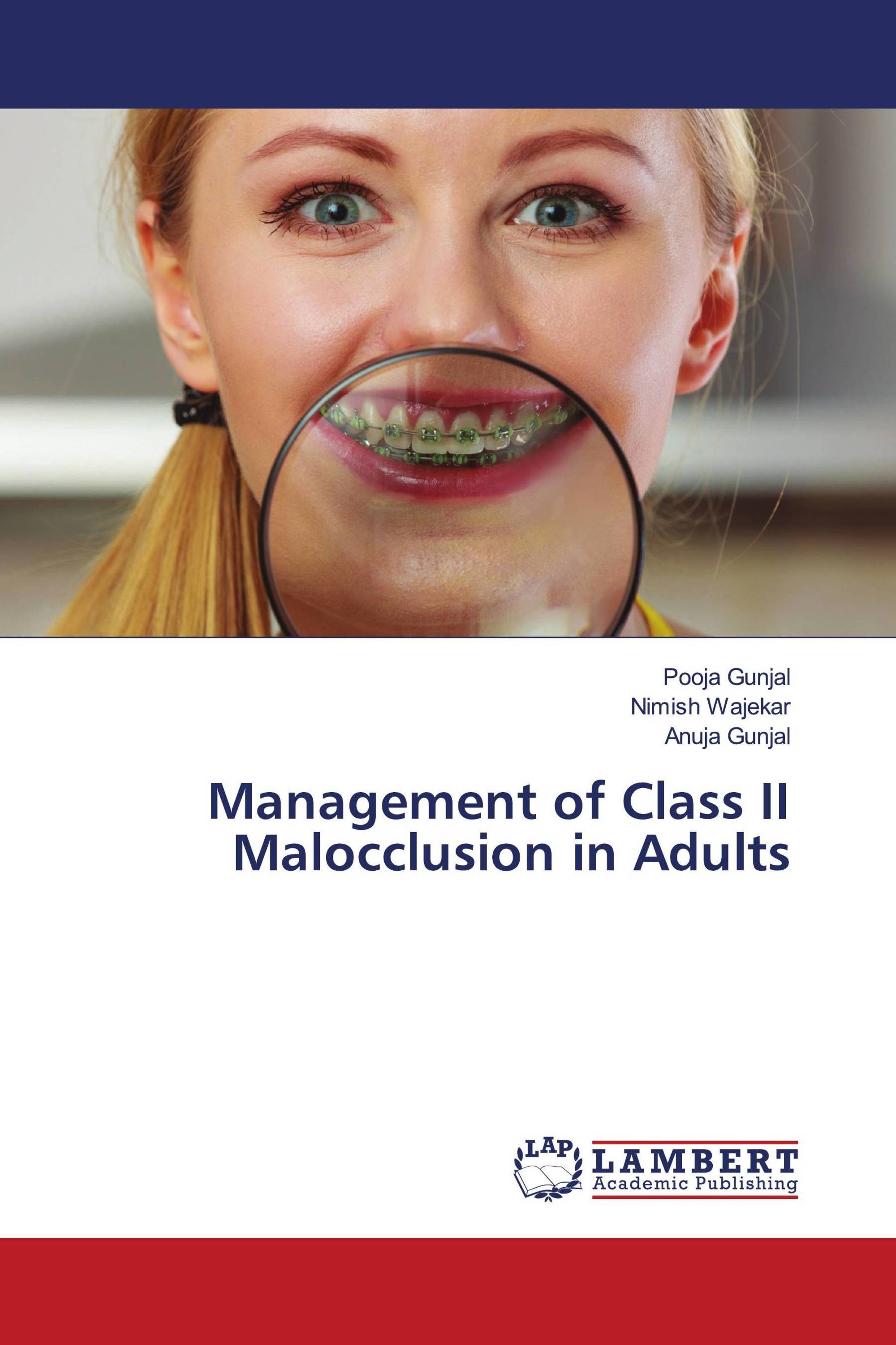 Management of Class II Malocclusion in Adults / 9786205491867