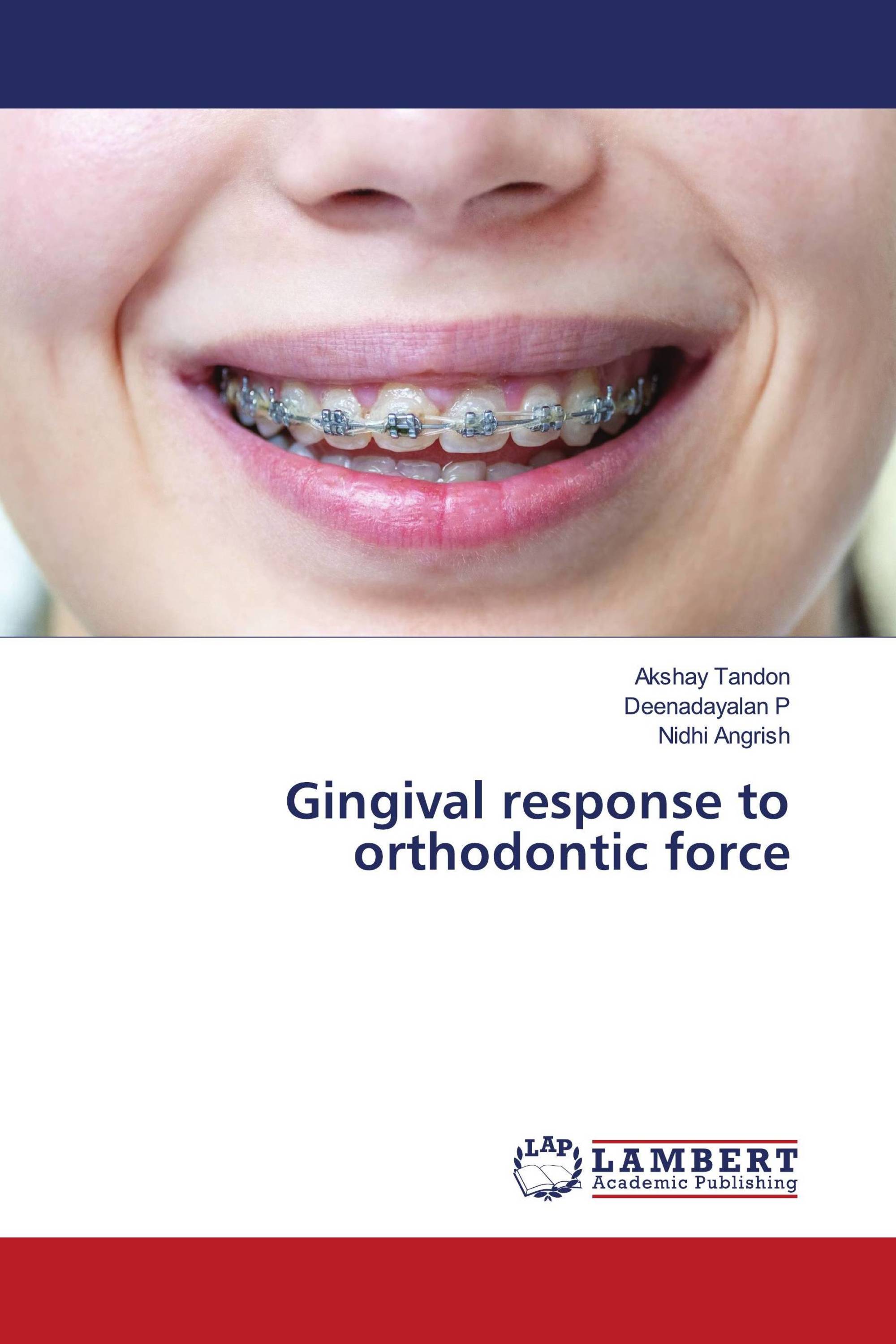 Gingival response to orthodontic force / 9786205492833