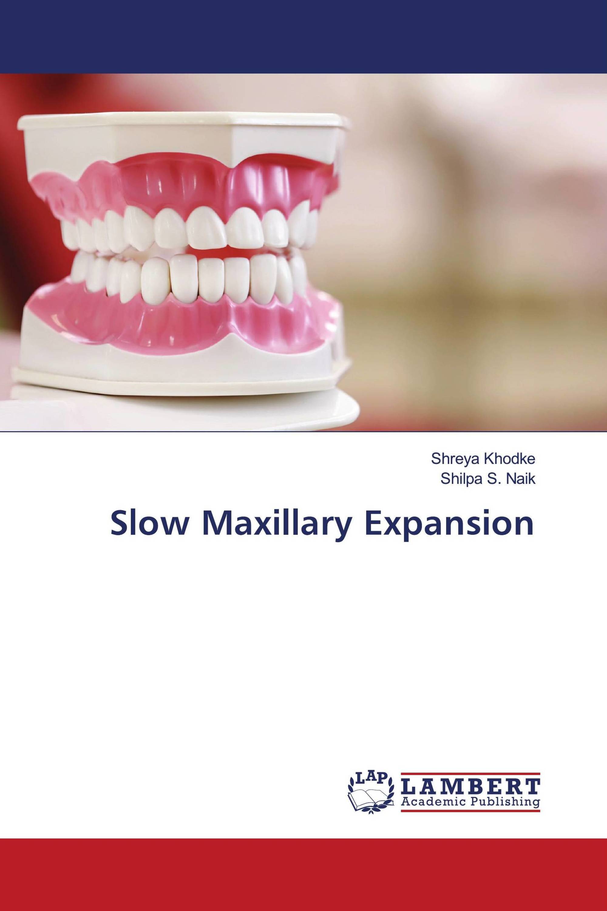 Slow Maxillary Expansion