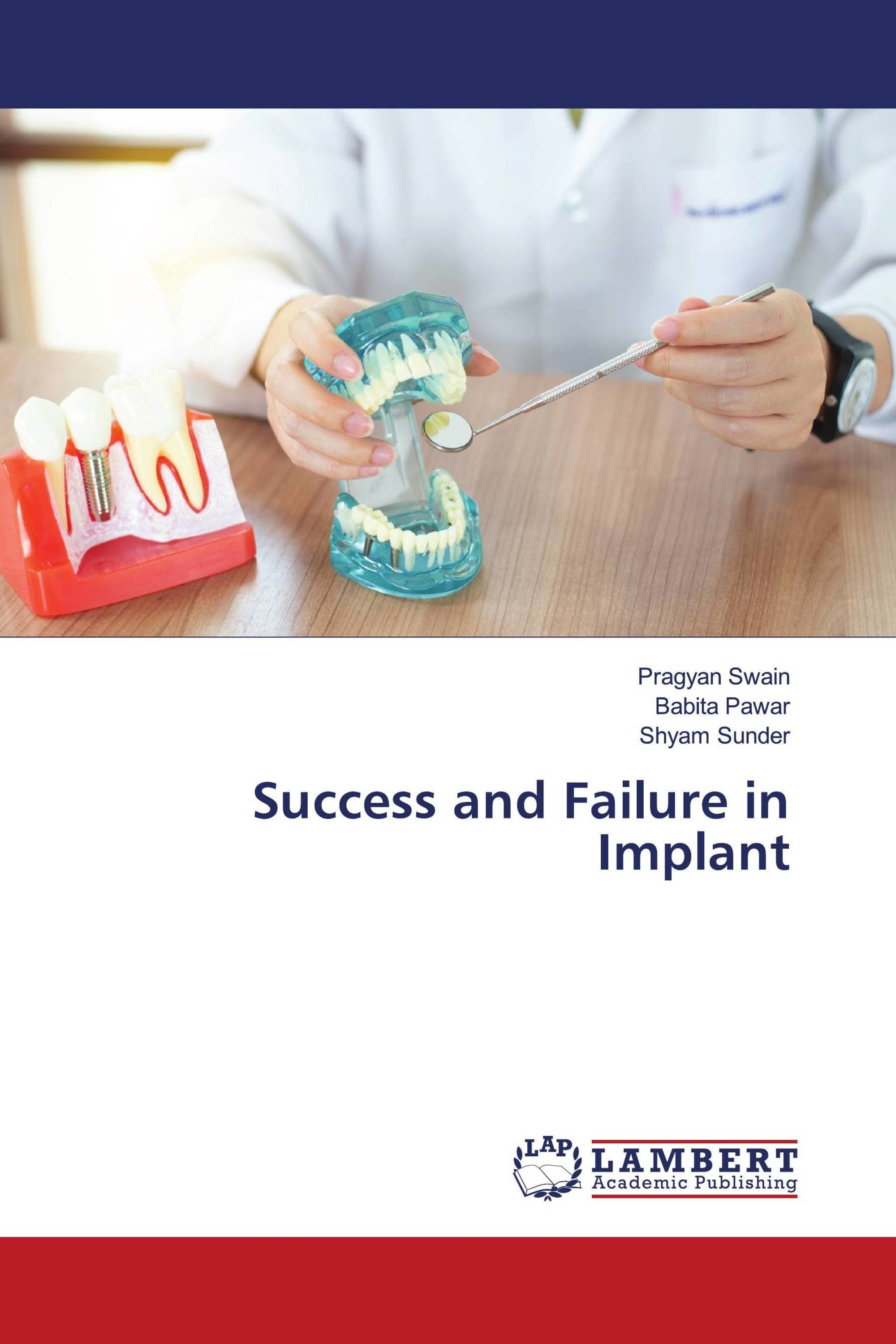 Success and Failure in Implant