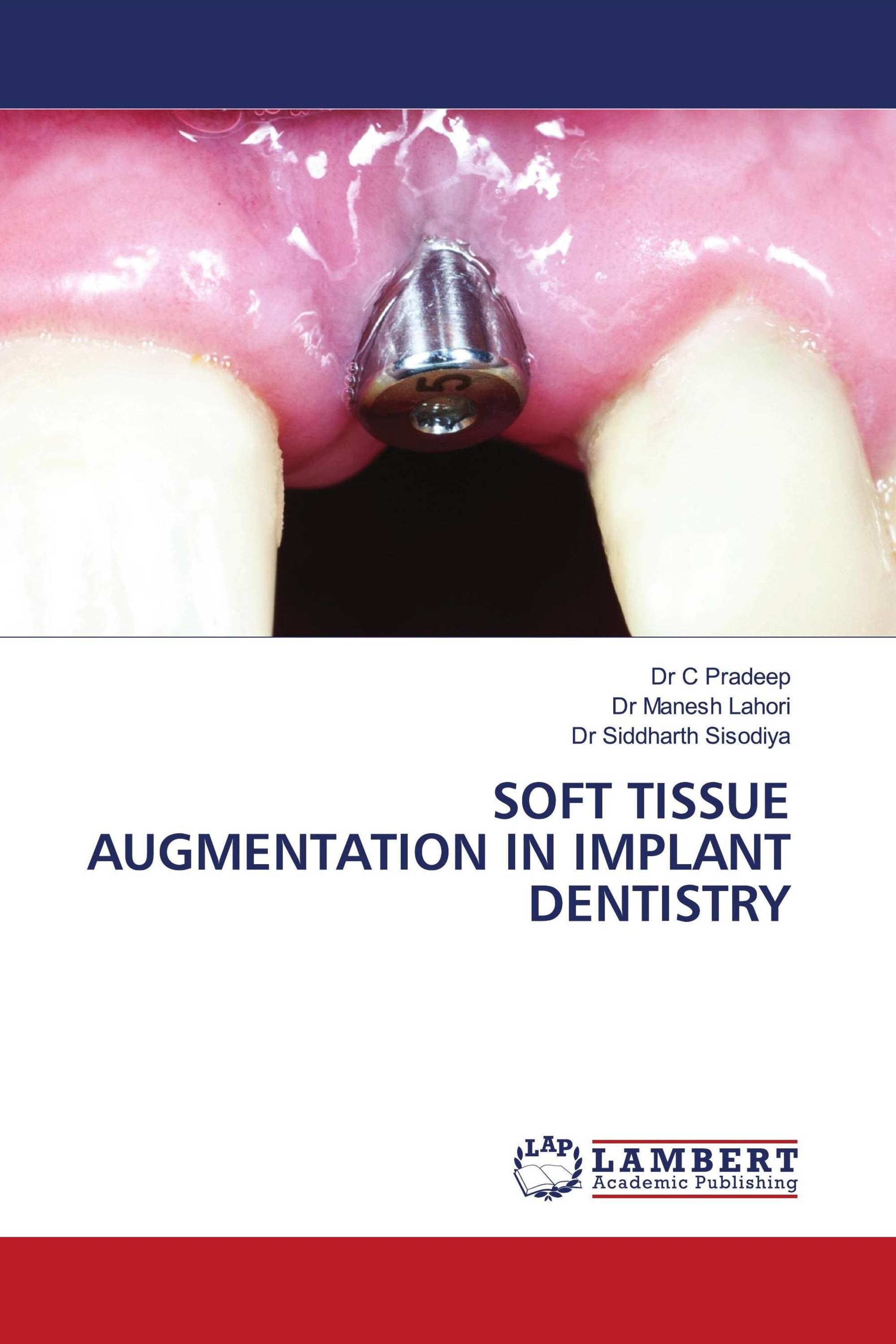 Soft Tissue Augmentation Procedures – KCCR
