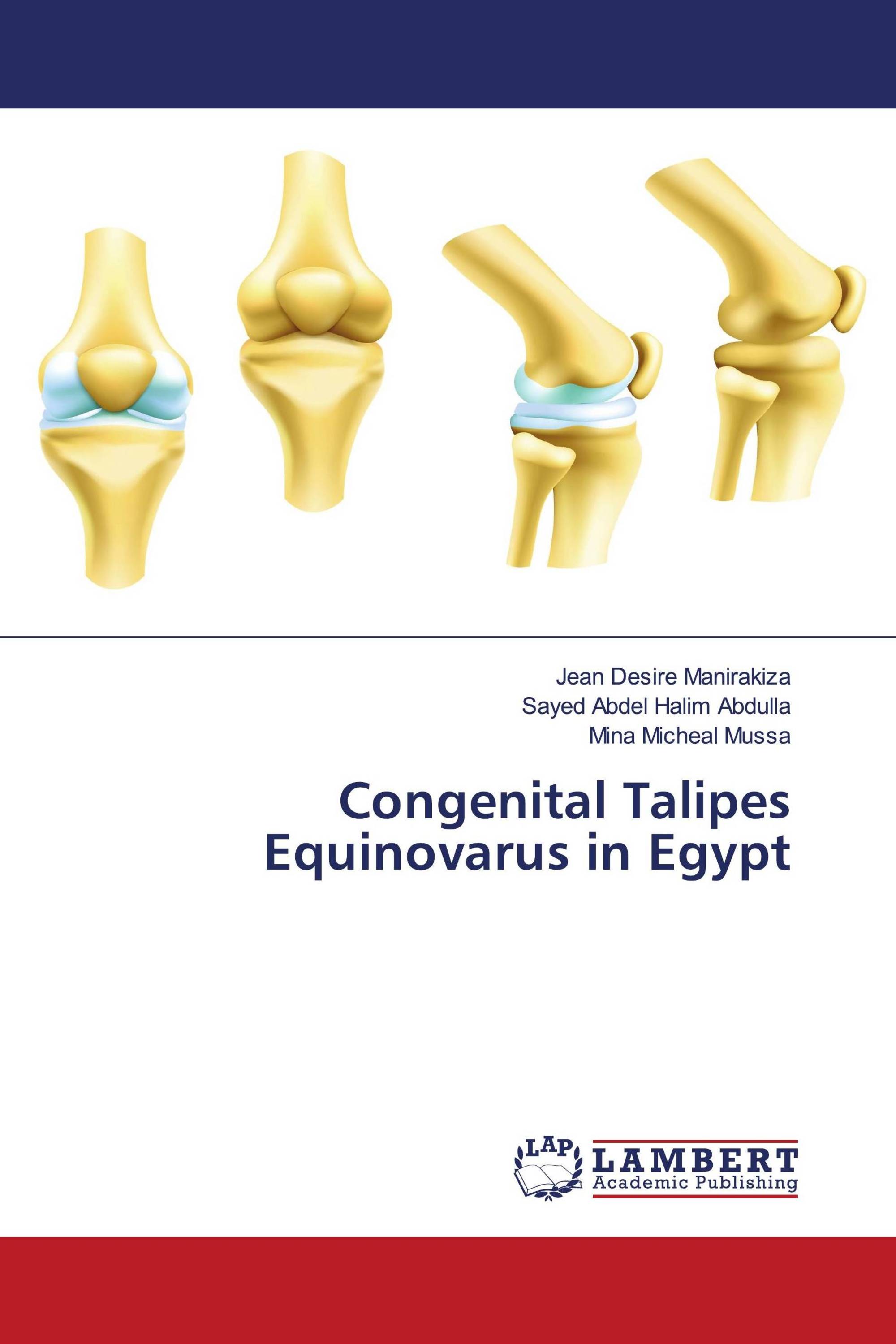 Congenital Talipes Equinovarus in Egypt / 9786205514870 / 9786205514870 / 6205514877