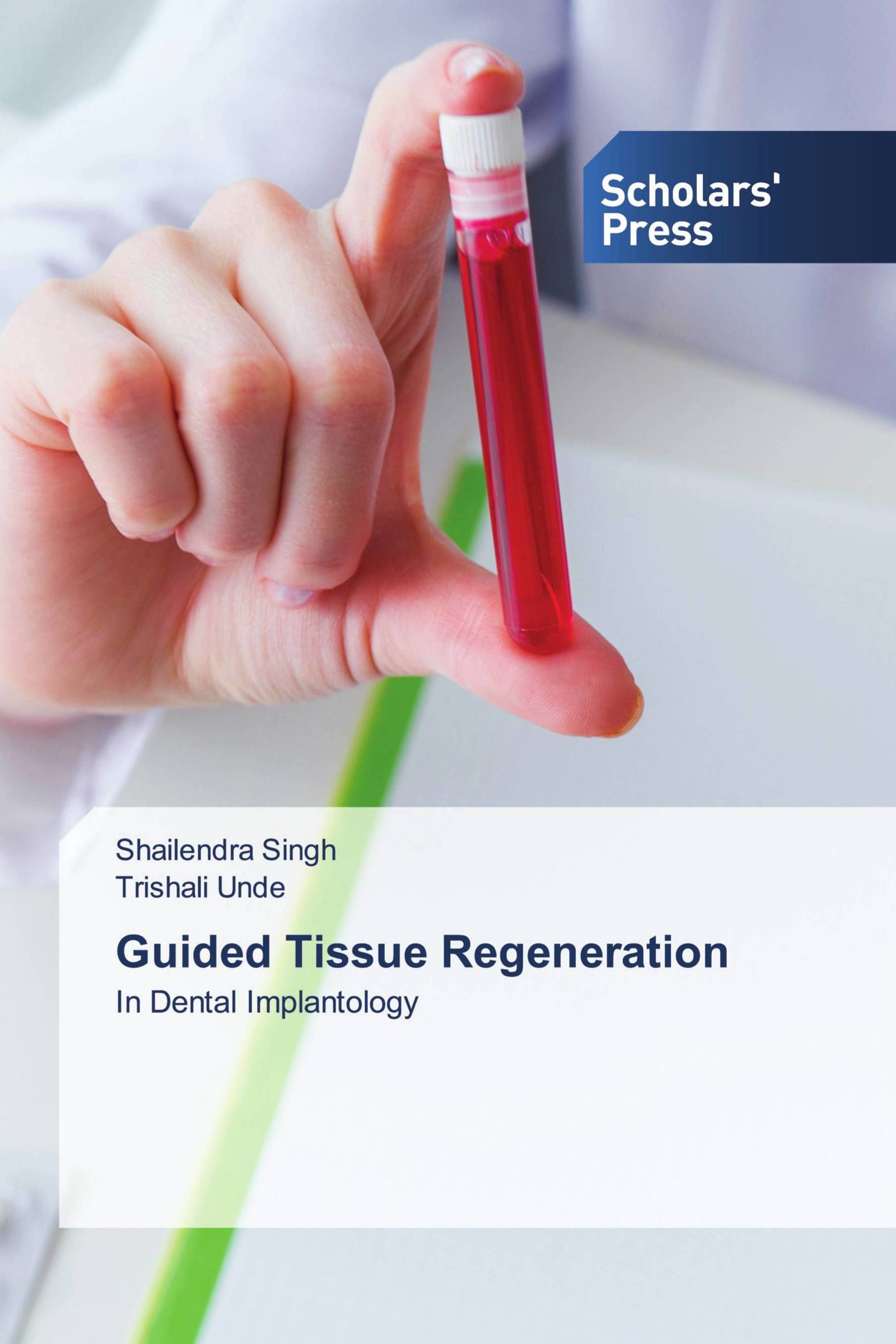 Guided Tissue Regeneration