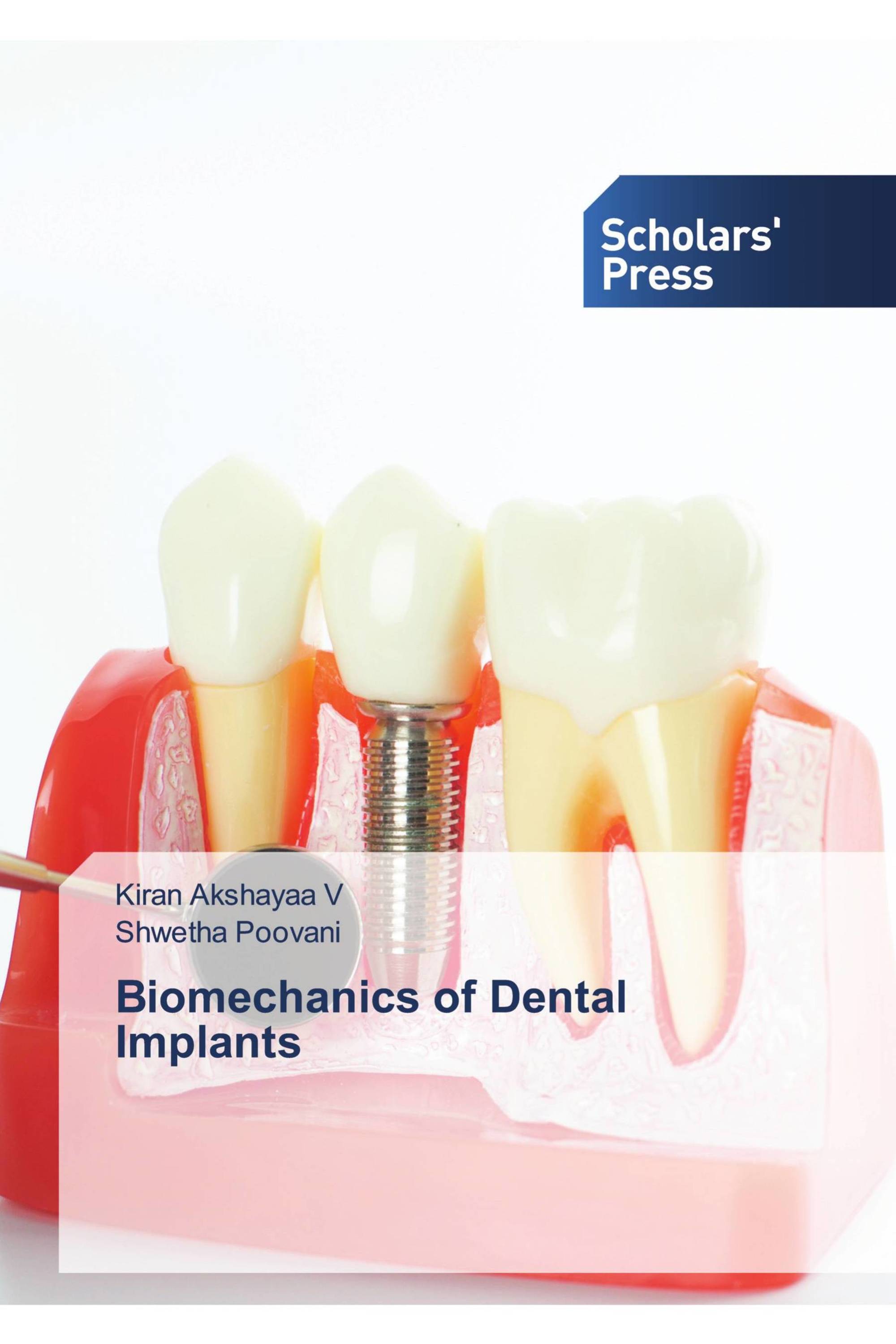 Biomechanics of Dental Implants