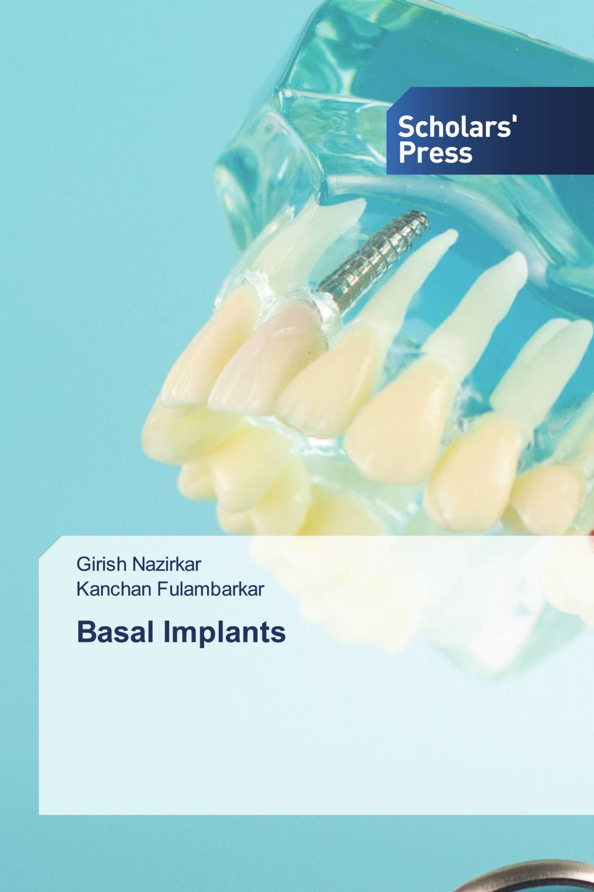 Basal Implants