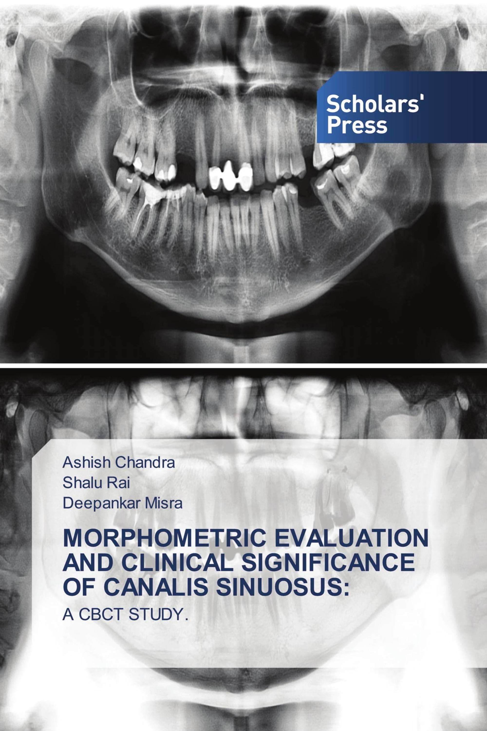 MORPHOMETRIC EVALUATION AND CLINICAL SIGNIFICANCE OF CANALIS SINUOSUS: