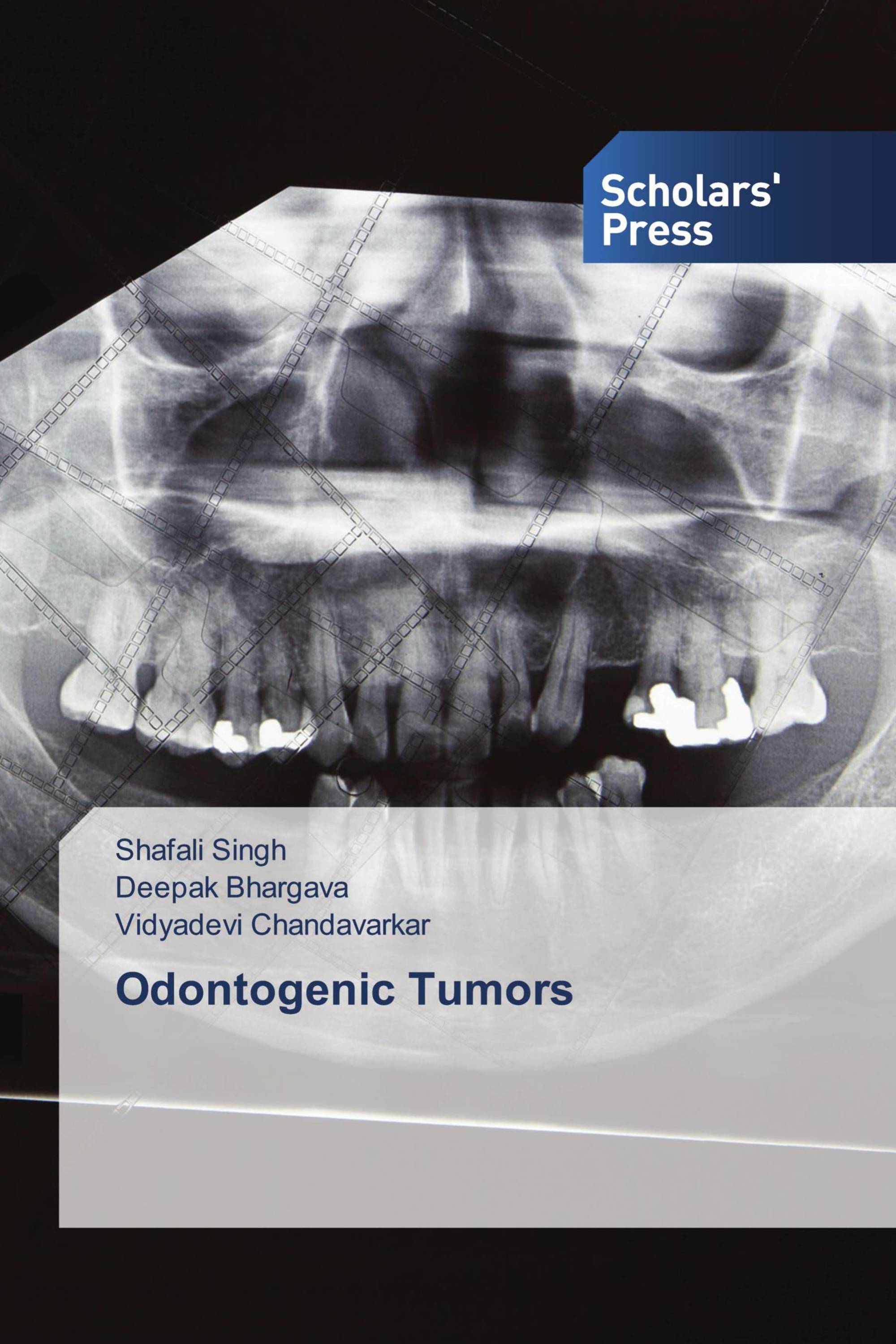 Odontogenic Tumors