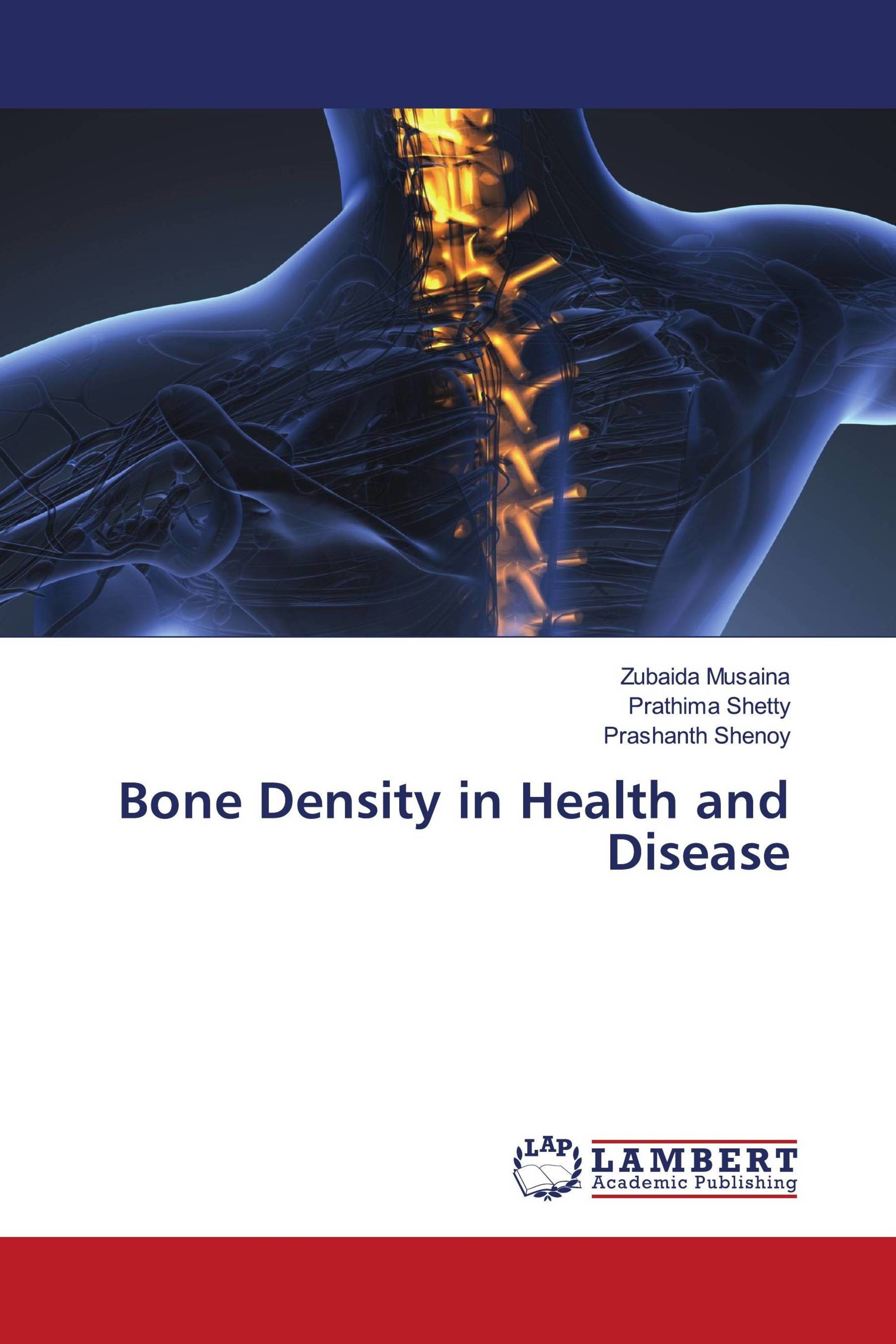 Bone Density in Health and Disease