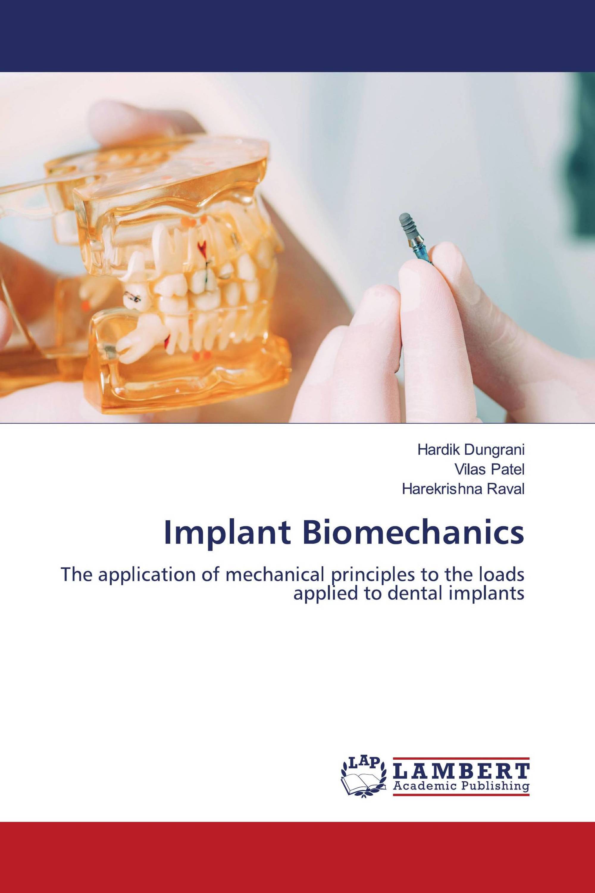 Implant Biomechanics / 9786205640685 / 9786205640685 / 6205640686