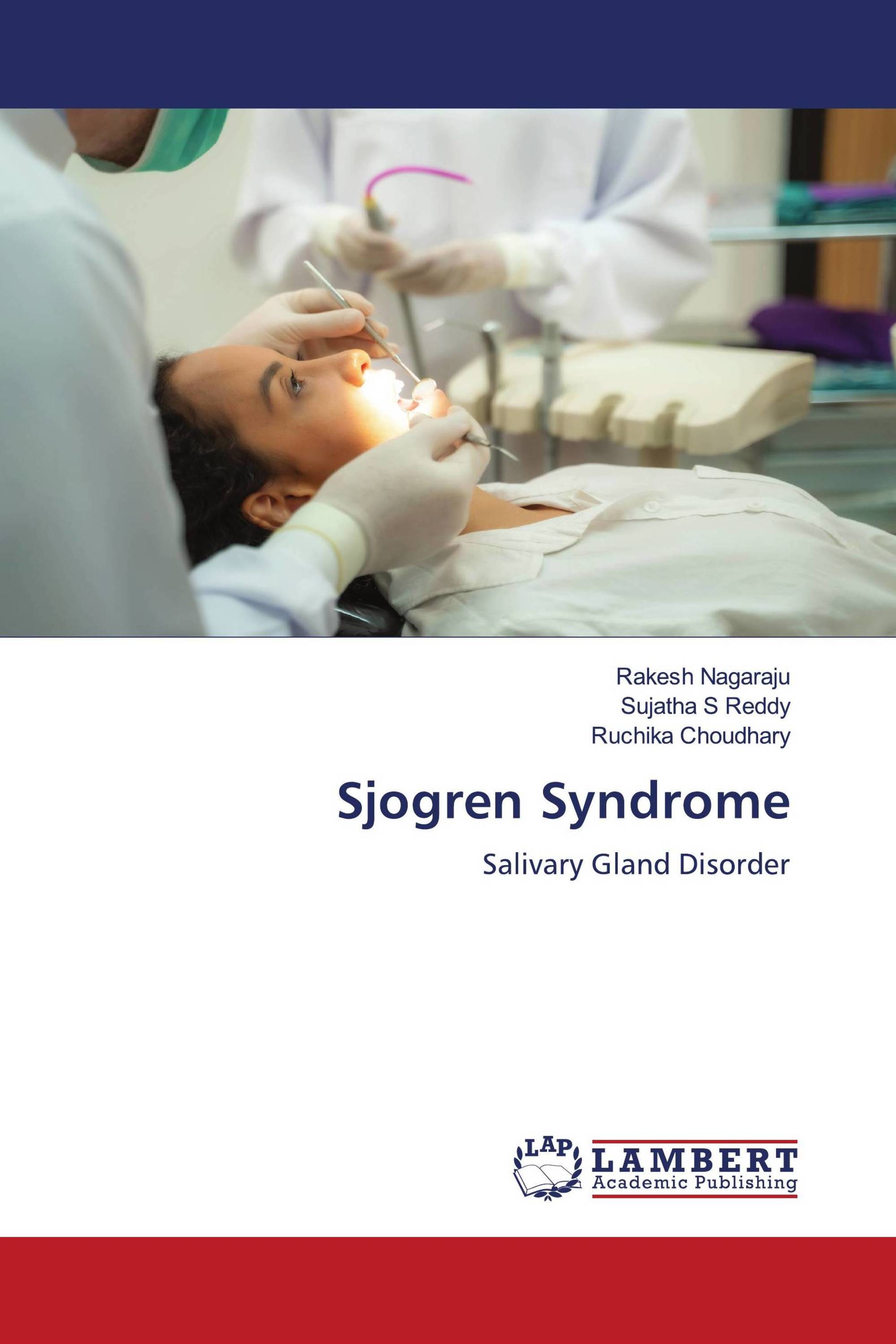 Sjogren Syndrome