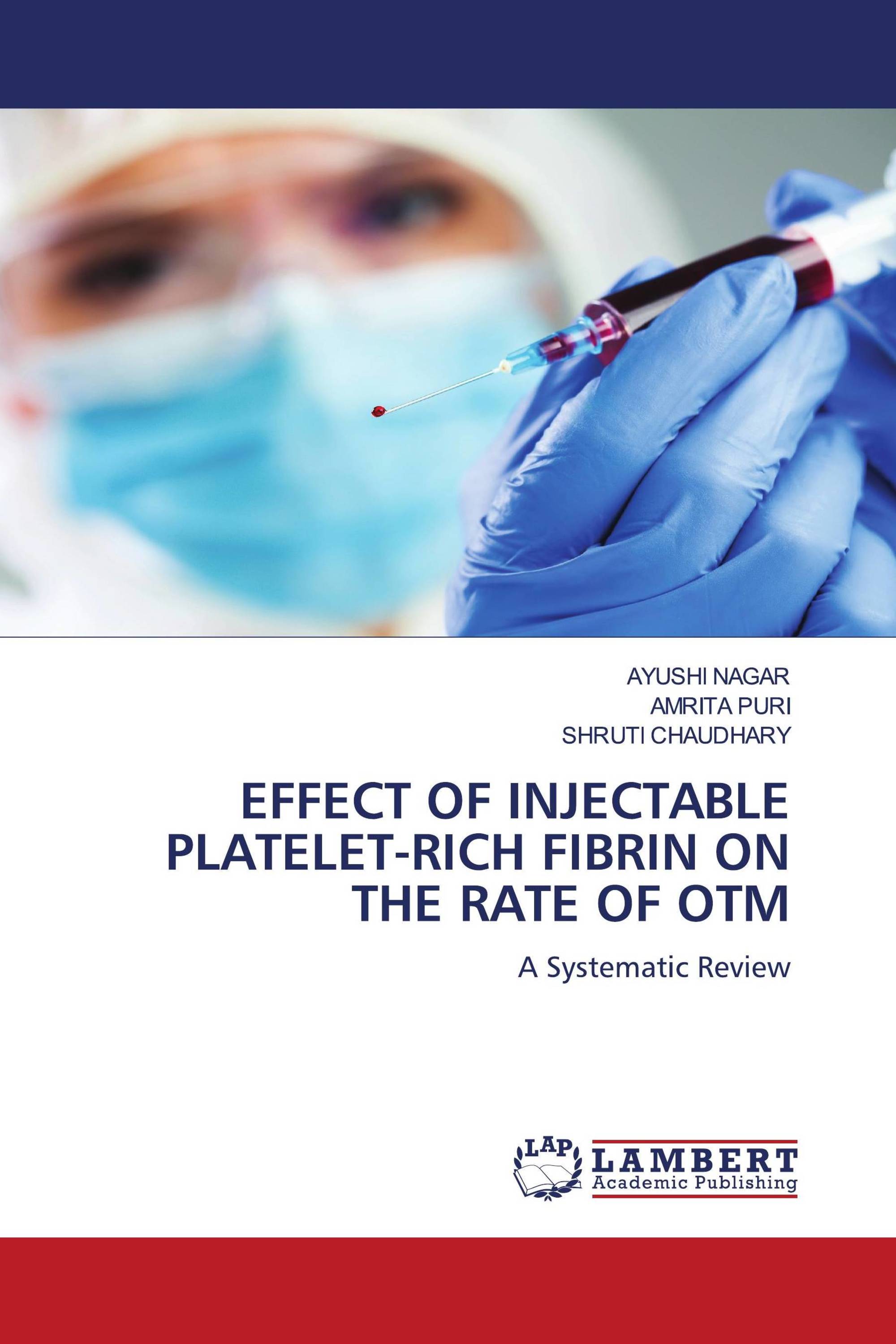 EFFECT OF INJECTABLE PLATELET-RICH FIBRIN ON THE RATE OF OTM