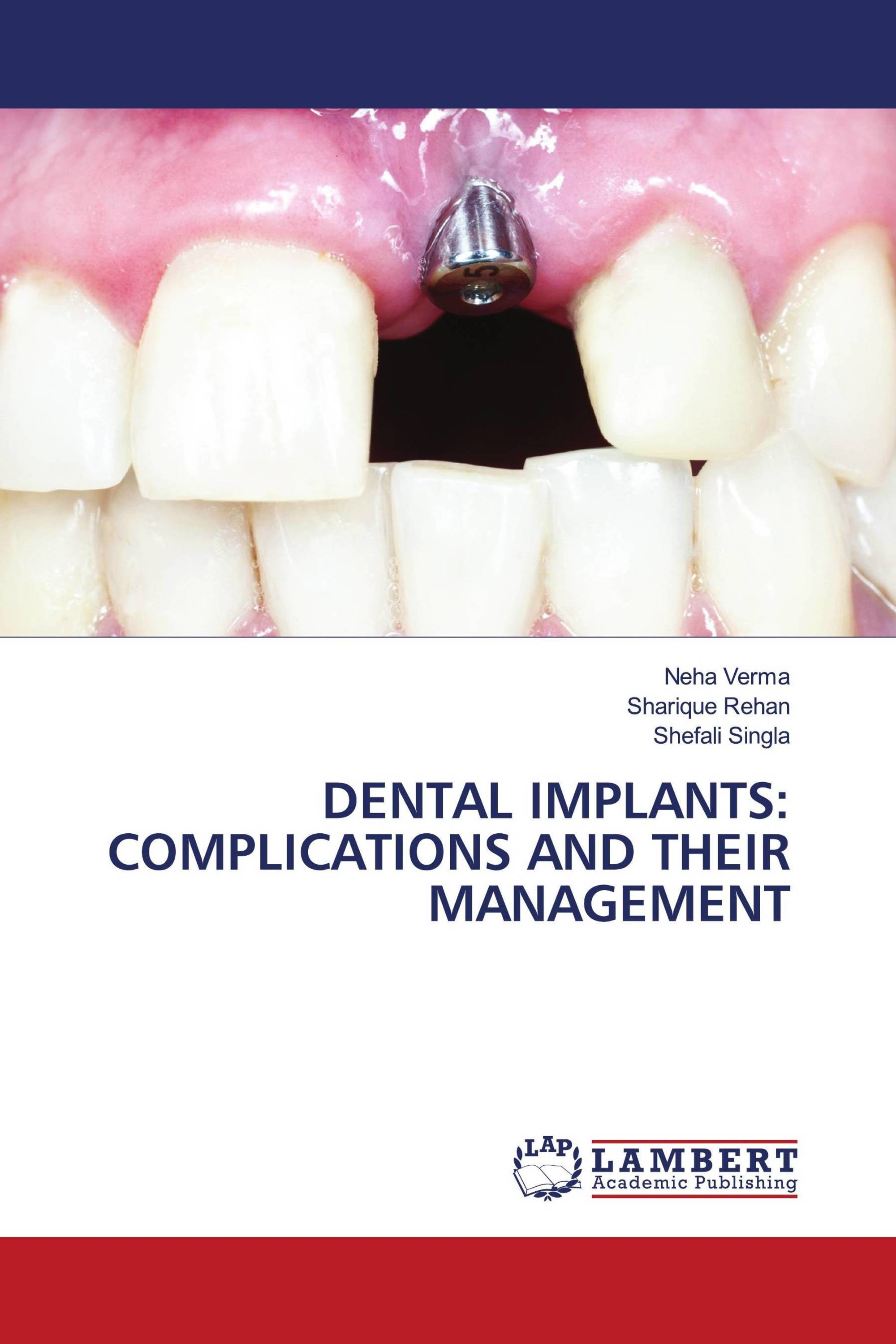 DENTAL IMPLANTS: COMPLICATIONS AND THEIR MANAGEMENT / 978-620-6-14211-9 ...