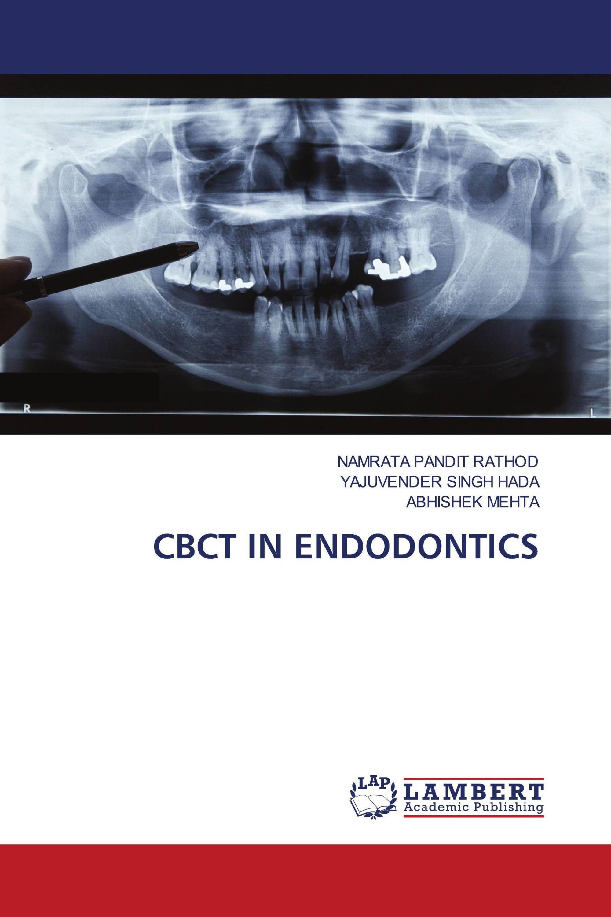 CBCT IN ENDODONTICS / 978-620-6-14232-4 / 9786206142324 / 6206142329