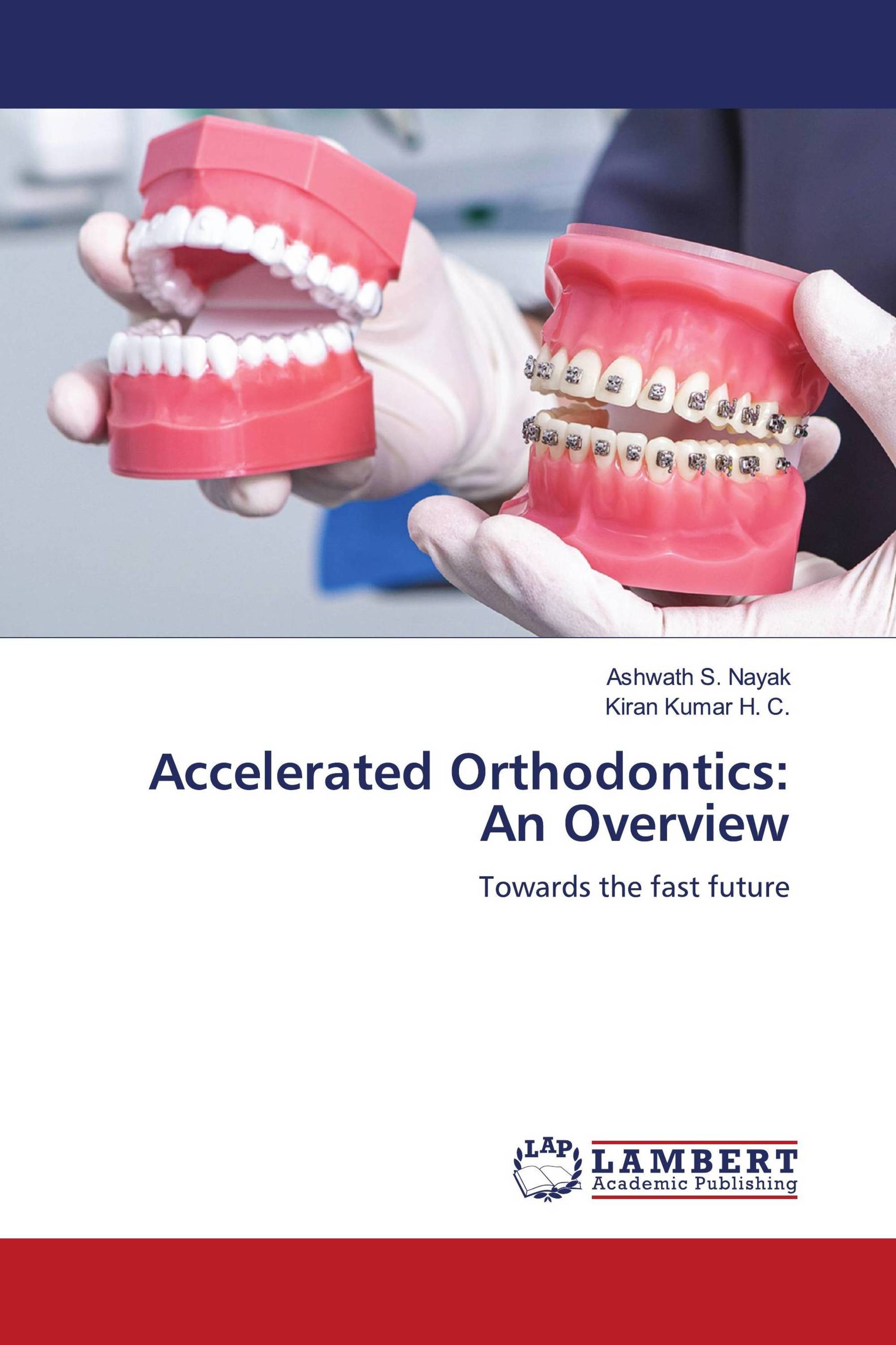 Accelerated Orthodontics: An Overview