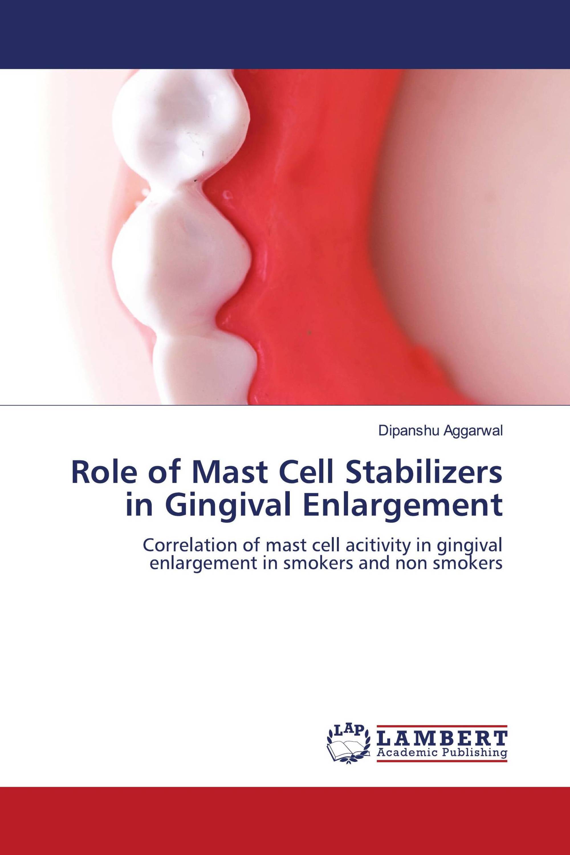 Role of Mast Cell Stabilizers in Gingival Enlargement